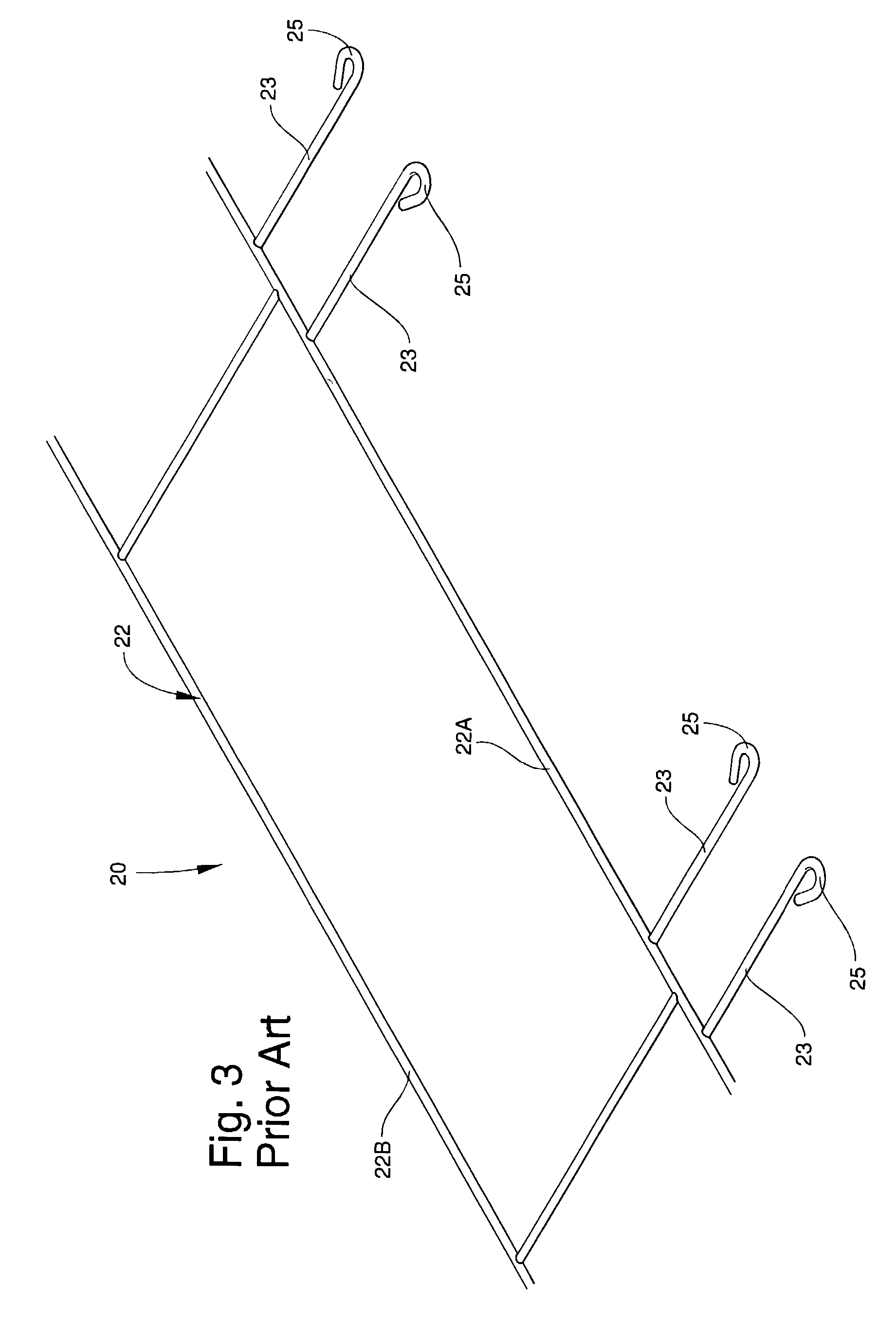 Masonry anchoring system