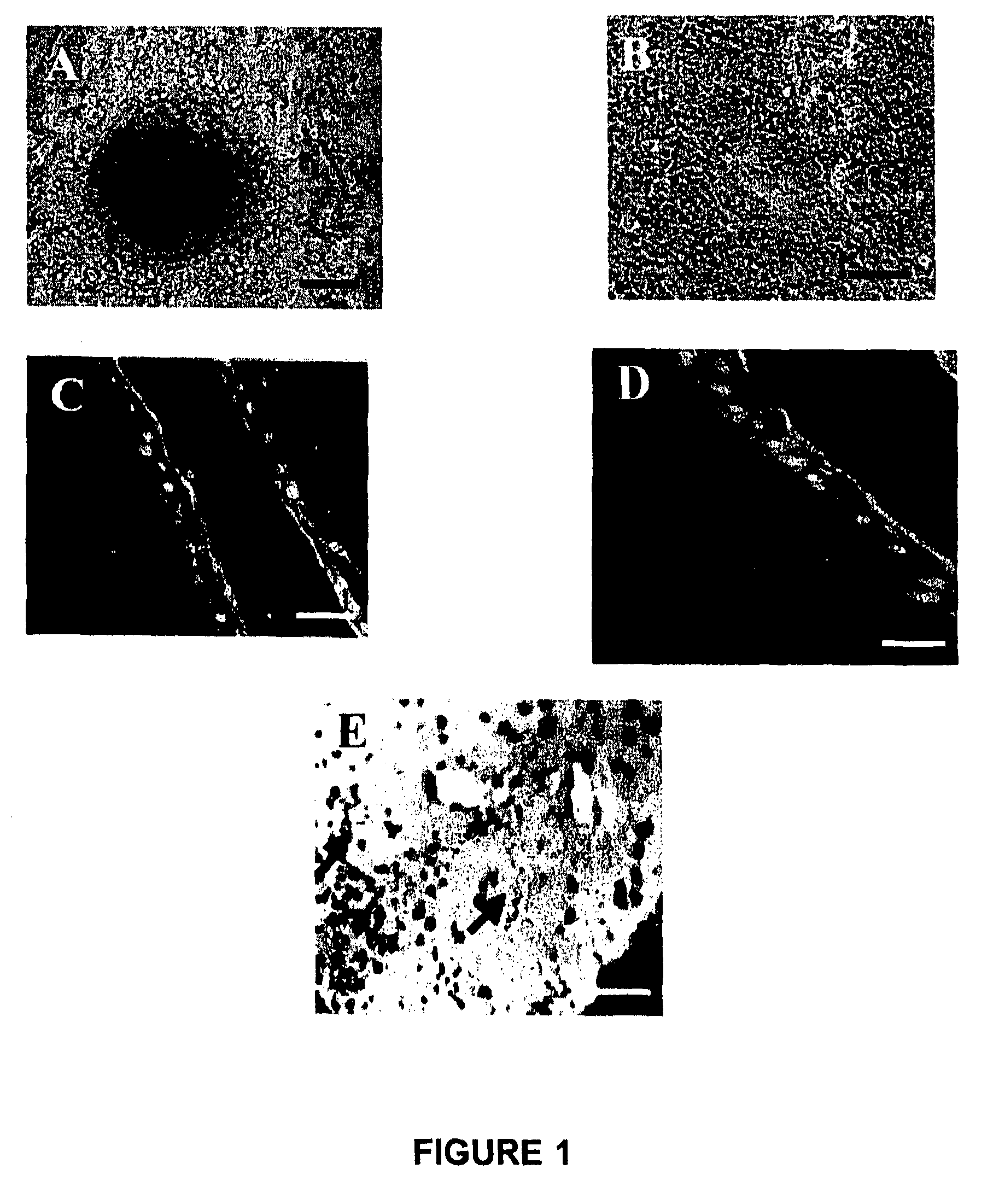 Conjunctival tissue system