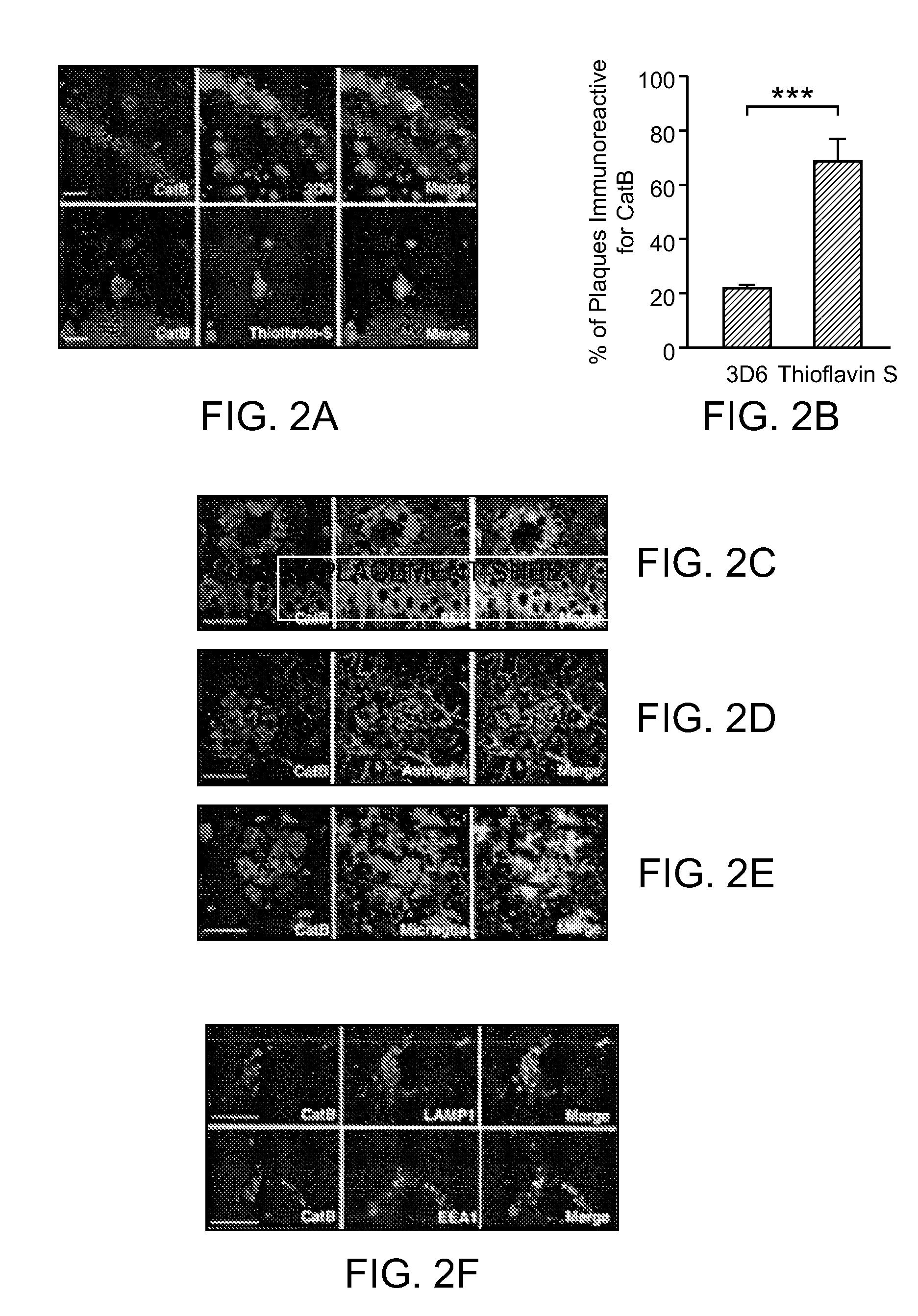 Methods and compositions for reducing amyloid beta levels