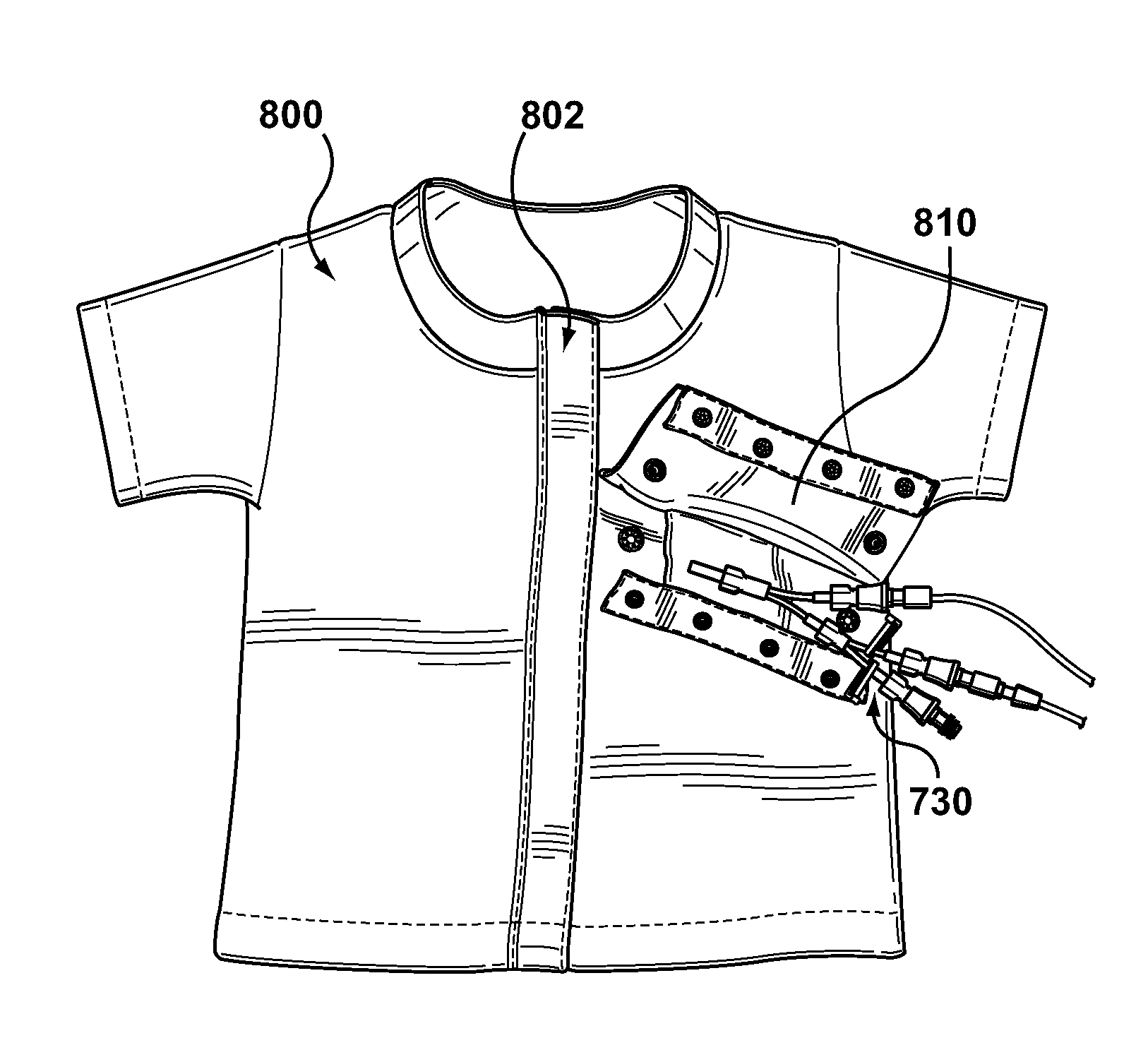 Garment for securing an external portion of a catheter