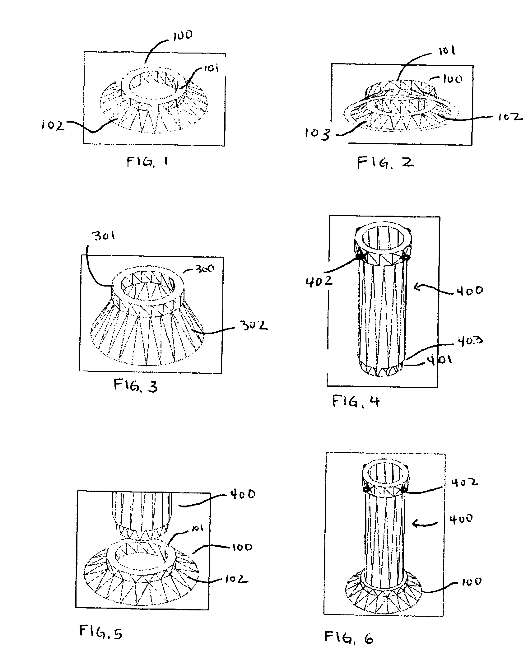 Apparatus and method for minimally invasive implantation of heart assist device