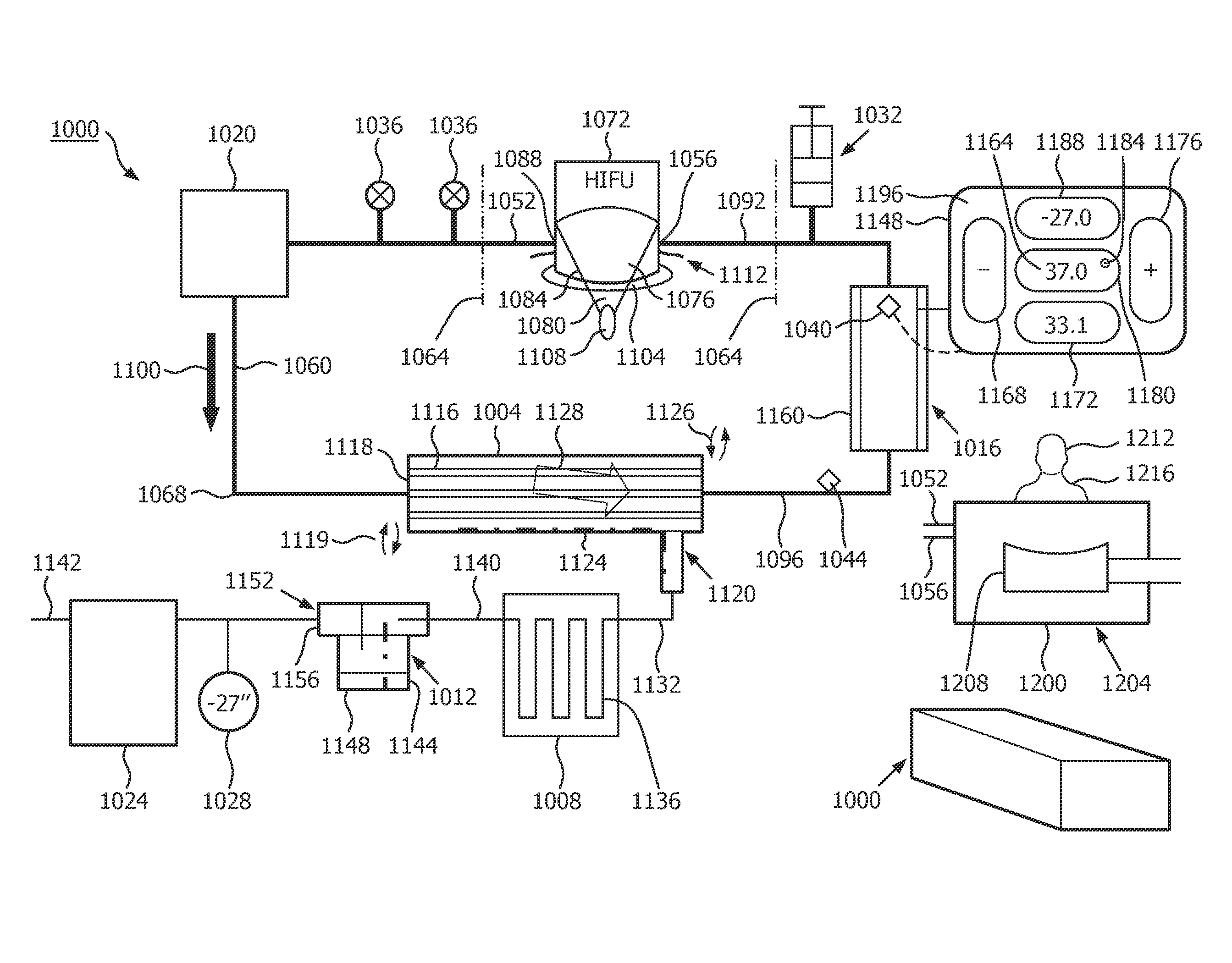 Heat exchange in fluid degassing