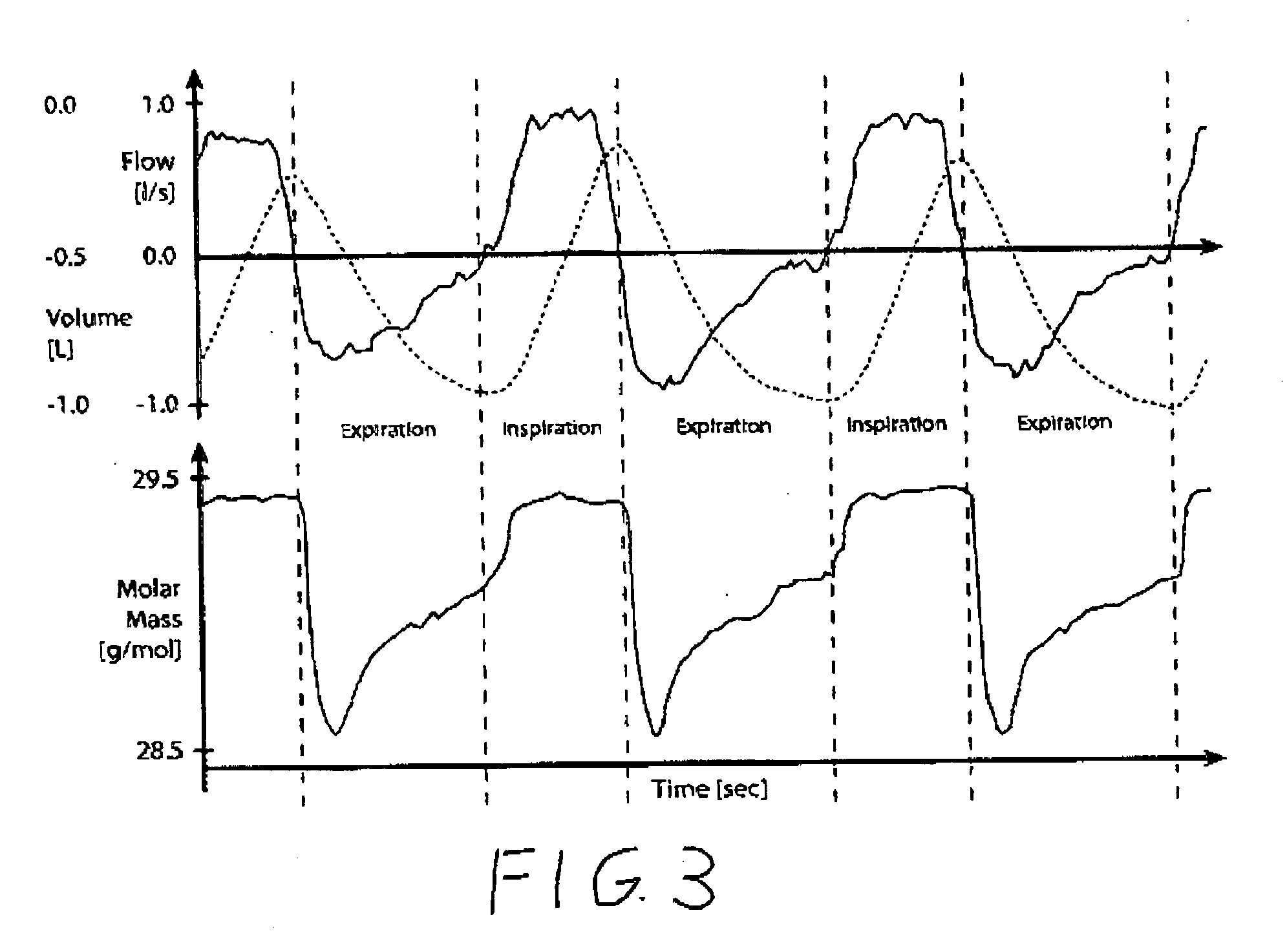 Method for non-cooperative lung function diagnosis using ultrasound