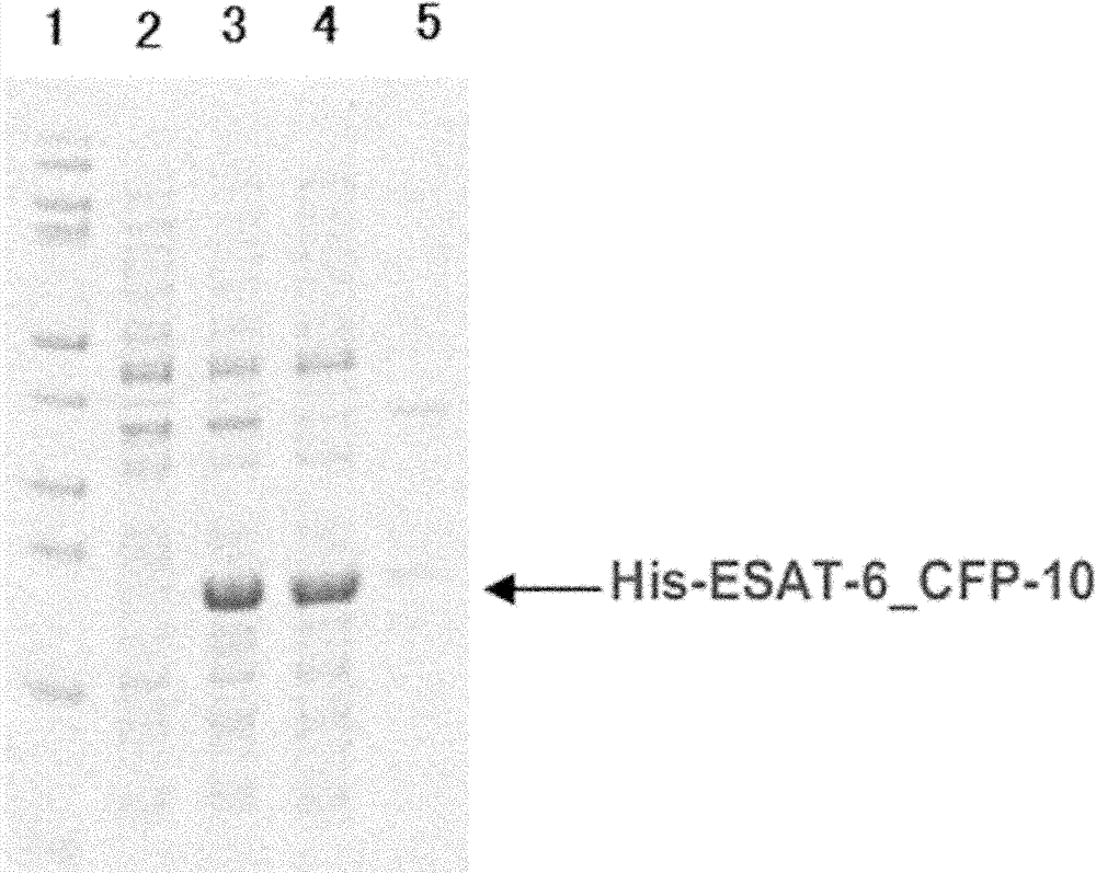 Detection kit for diagnosing tuberculosis