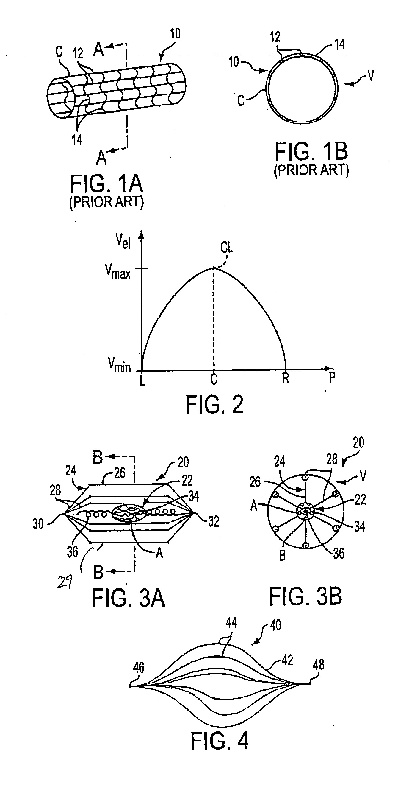 Implantable device for treating disease states and methods of using same