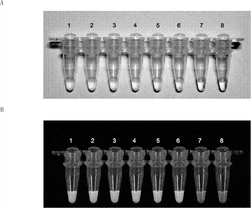 Loop-mediated isothermal amplification kit for detecting BYD viruses, and its application