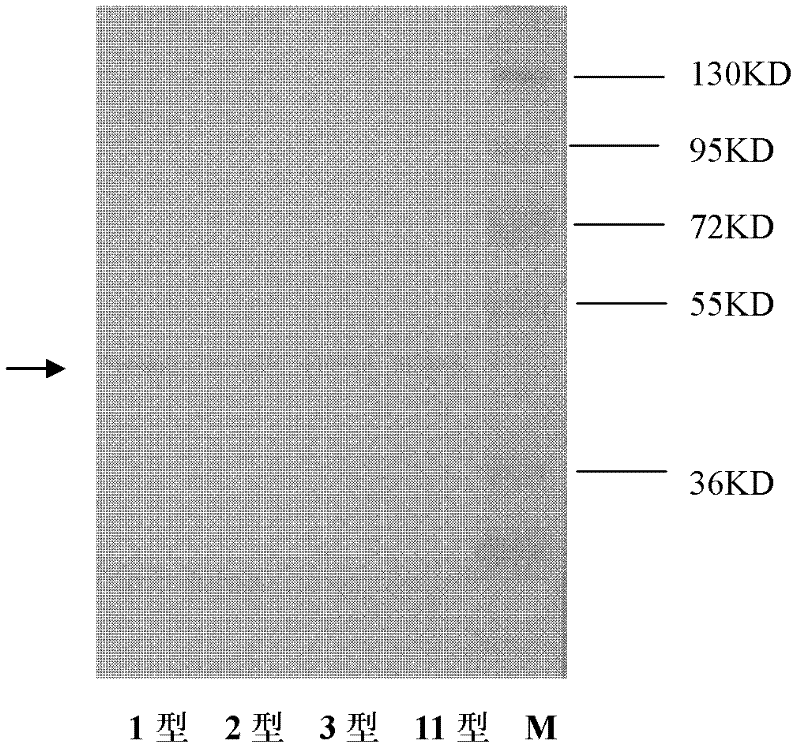 Monoclonal antibody against riemerella anatipestifer (RA)