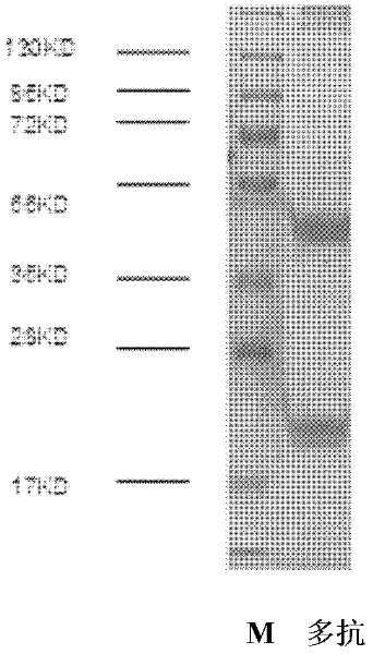 Monoclonal antibody against riemerella anatipestifer (RA)