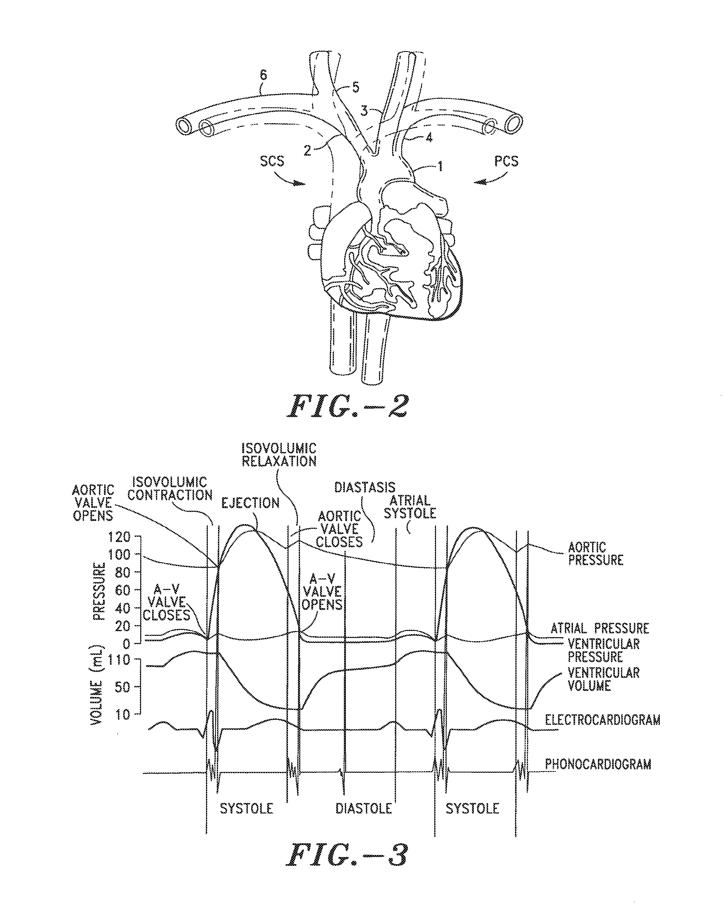 Method and system for determining cardiac performance