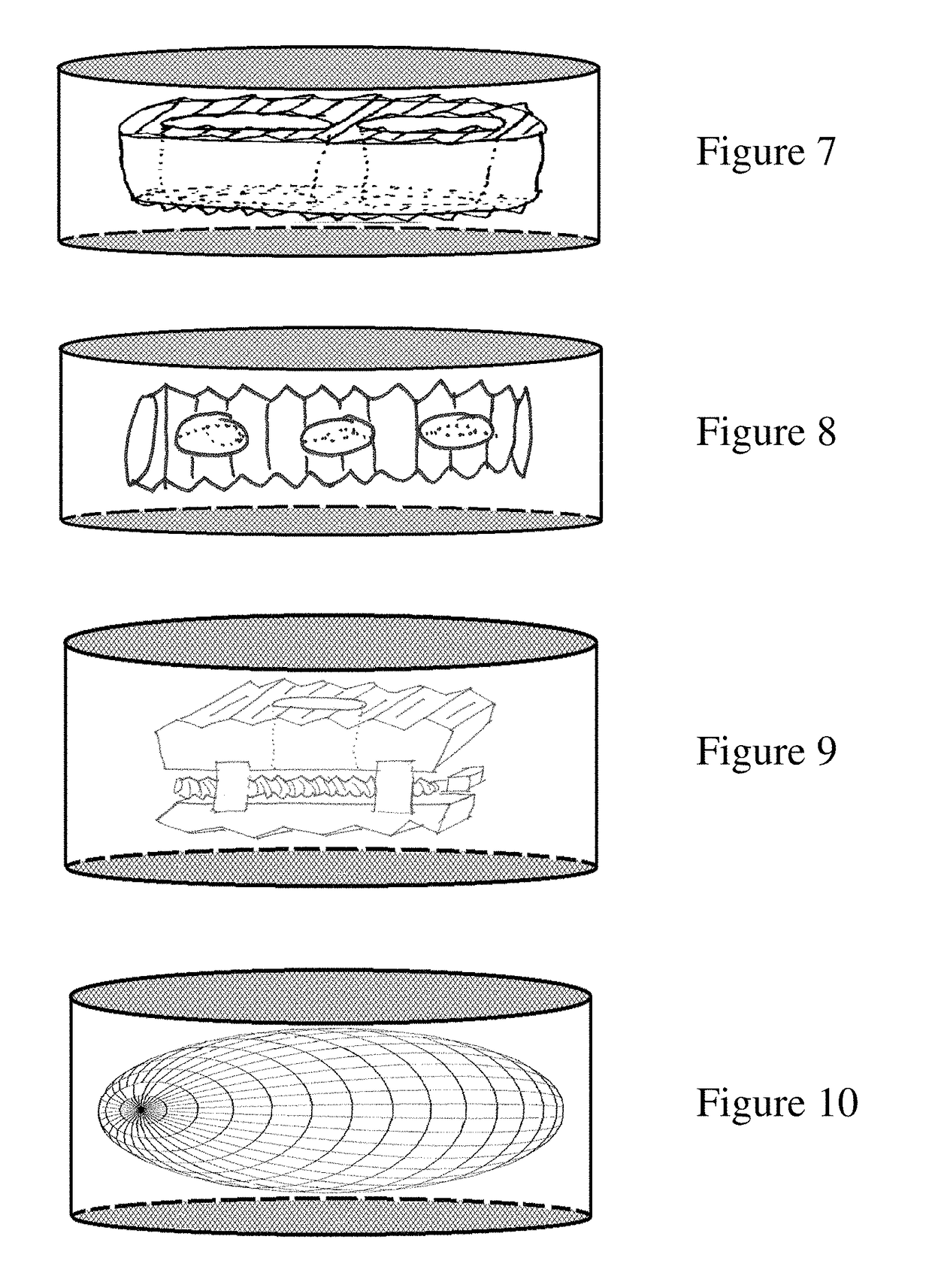 Sac for use in spinal surgery