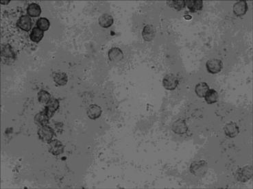 In-situ hybridization assay kit for mRNA level of premalignant pancreatic cancer ATDC (telangiectasia group D associated protein) gene as well as assay method and application