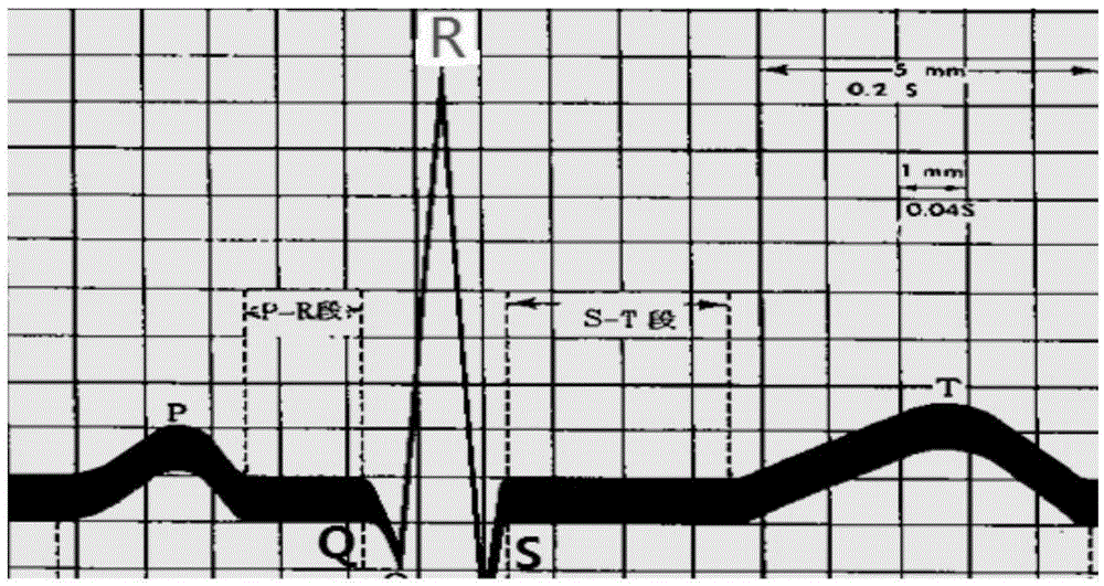 Electrocardiogram data analysis method and system
