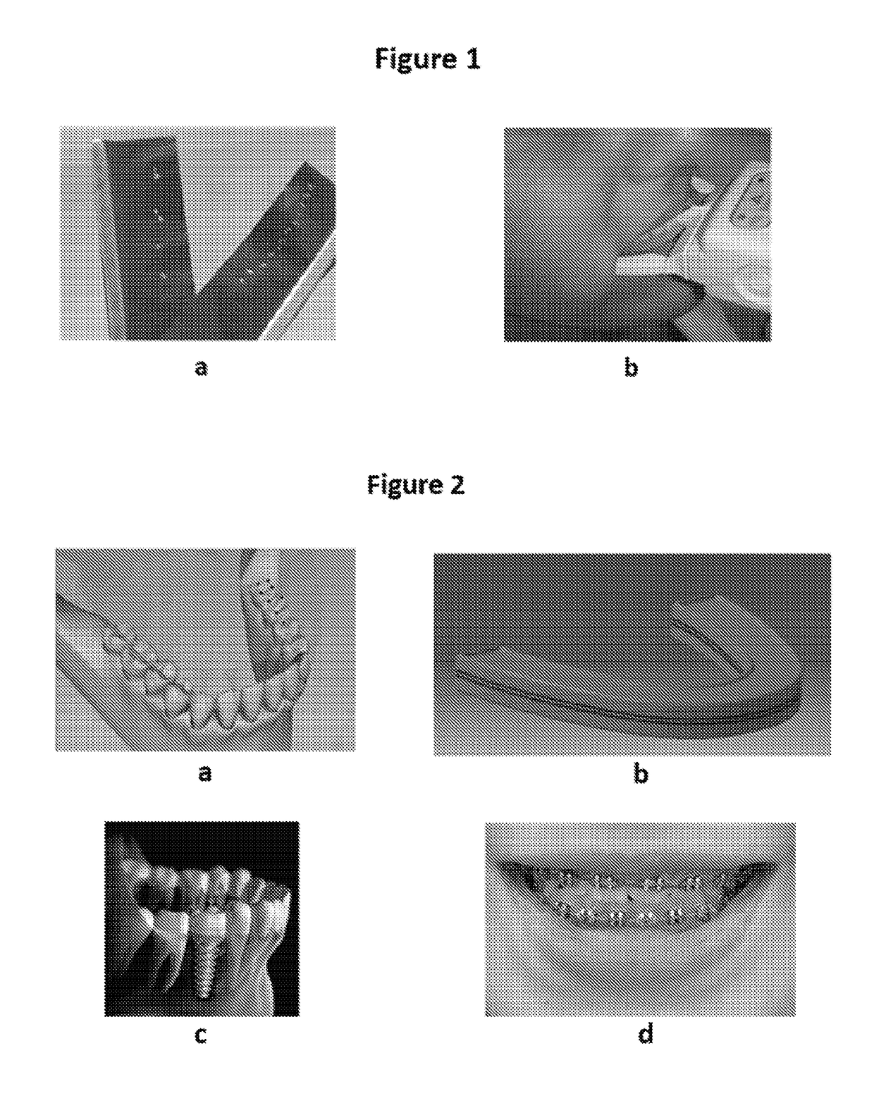 Capacitive Sensor Array for Dental Occlusion Monitoring