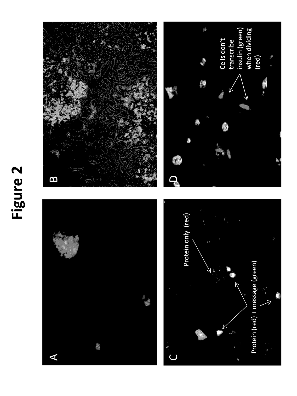Neo-islets comprising stem and islet cells and treatment of diabetes mellitus therewith
