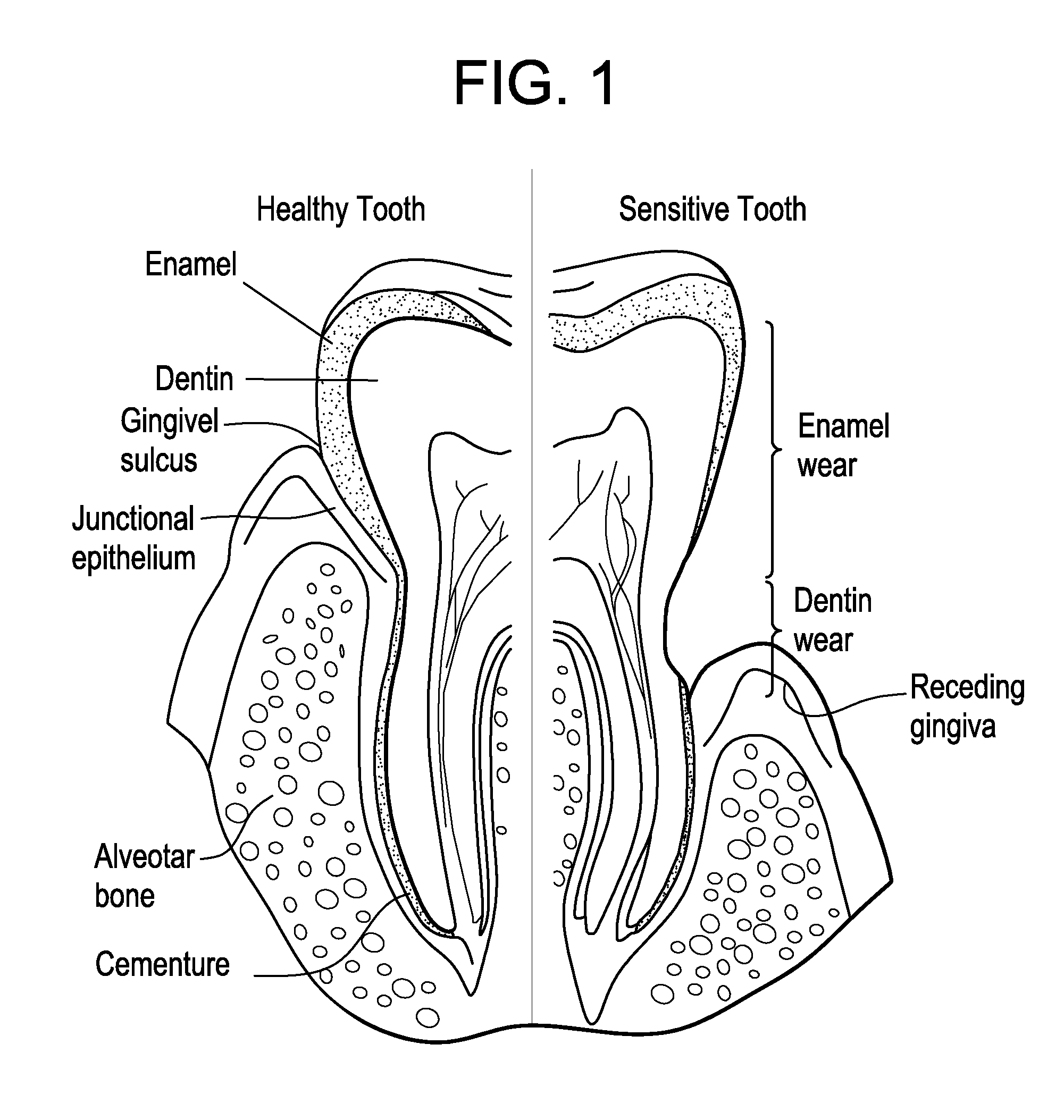 Oral care compositions for treatment of sensitive teeth