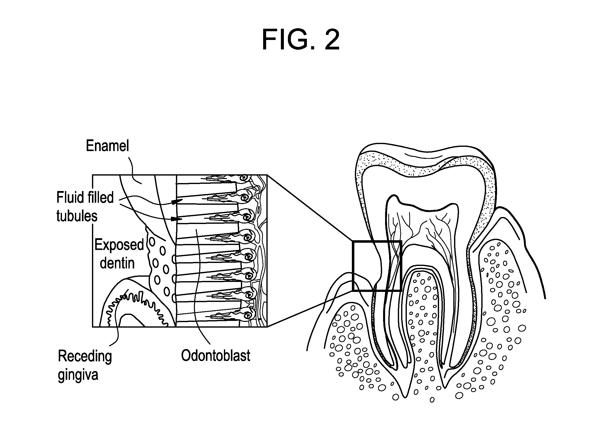 Oral care compositions for treatment of sensitive teeth