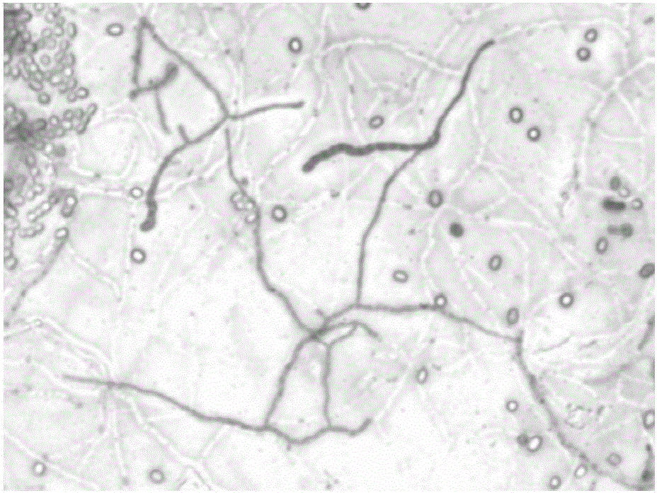 Keratinase-producing streptomyces rutgersensis LT-2 and application method thereof