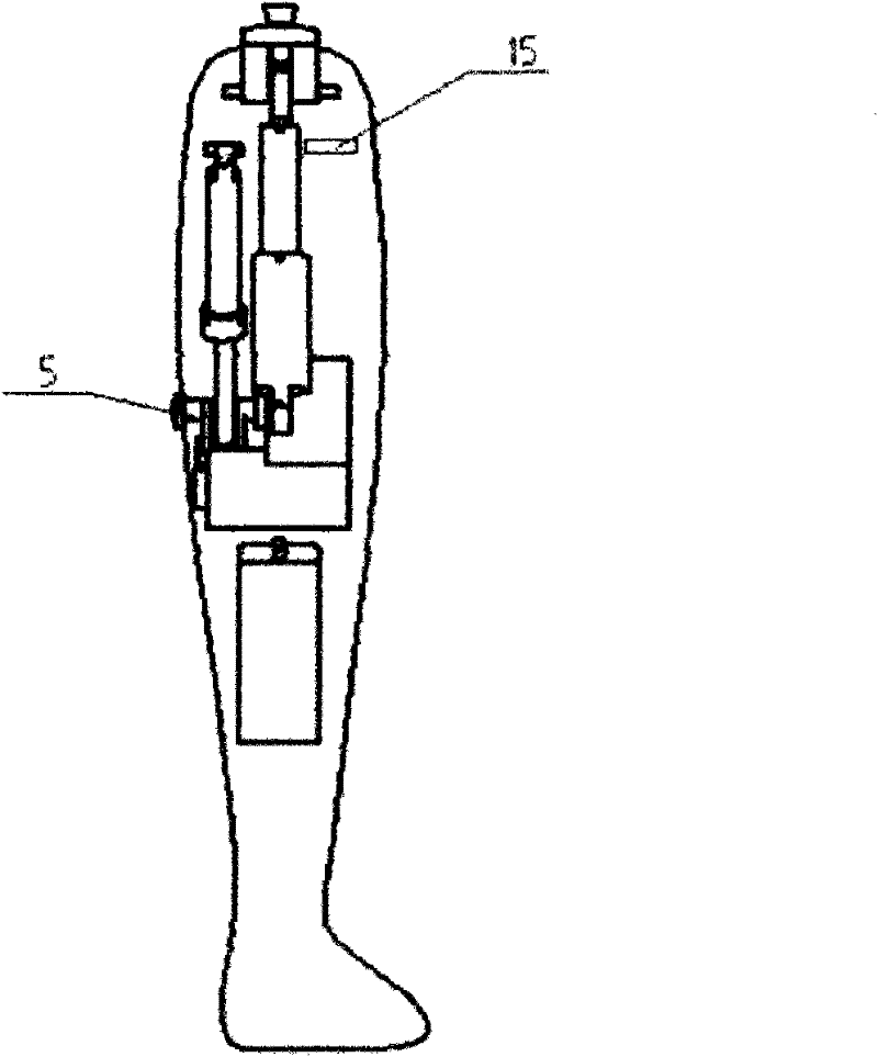 Myoelectric Knee