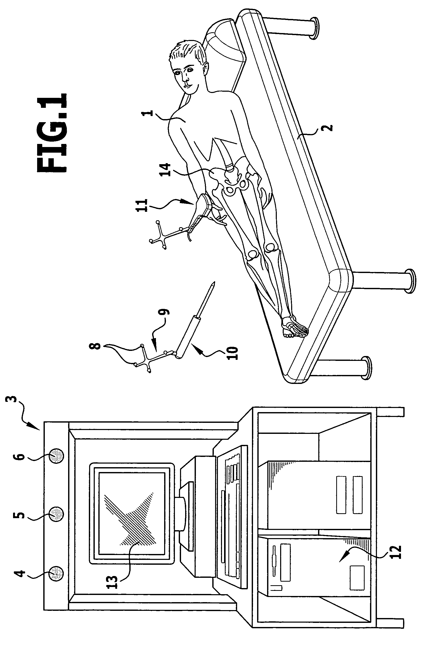 Method and apparatus for determining the angular position of an acetabulum in a pelvic bone