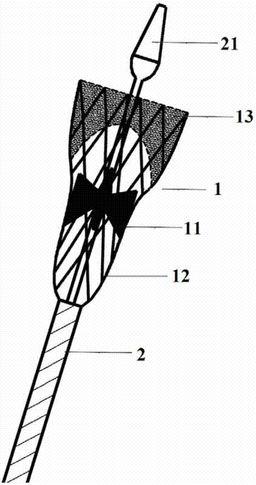 Self-expandable interventional valve and utilization method thereof