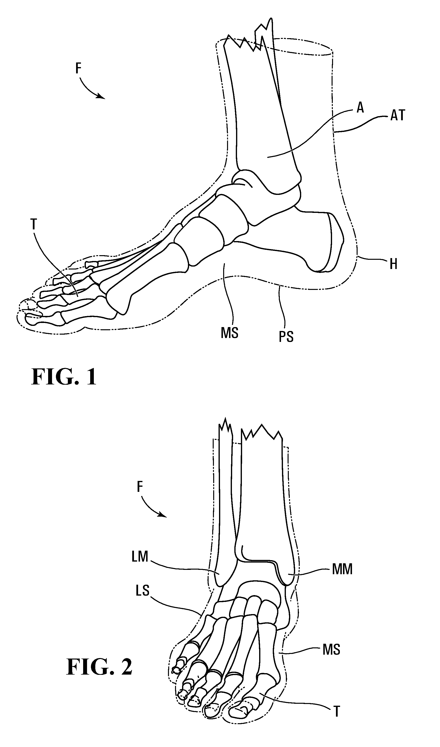 Method of making a lasted skate boot