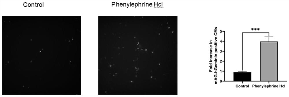 The new application of phenylephrine hydrochloride