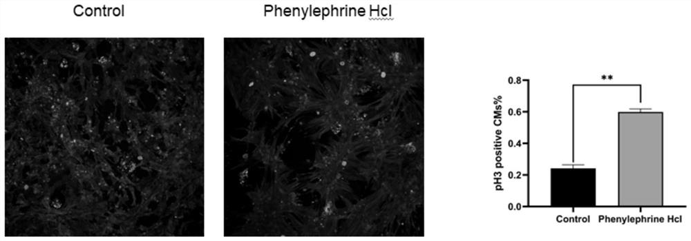 The new application of phenylephrine hydrochloride