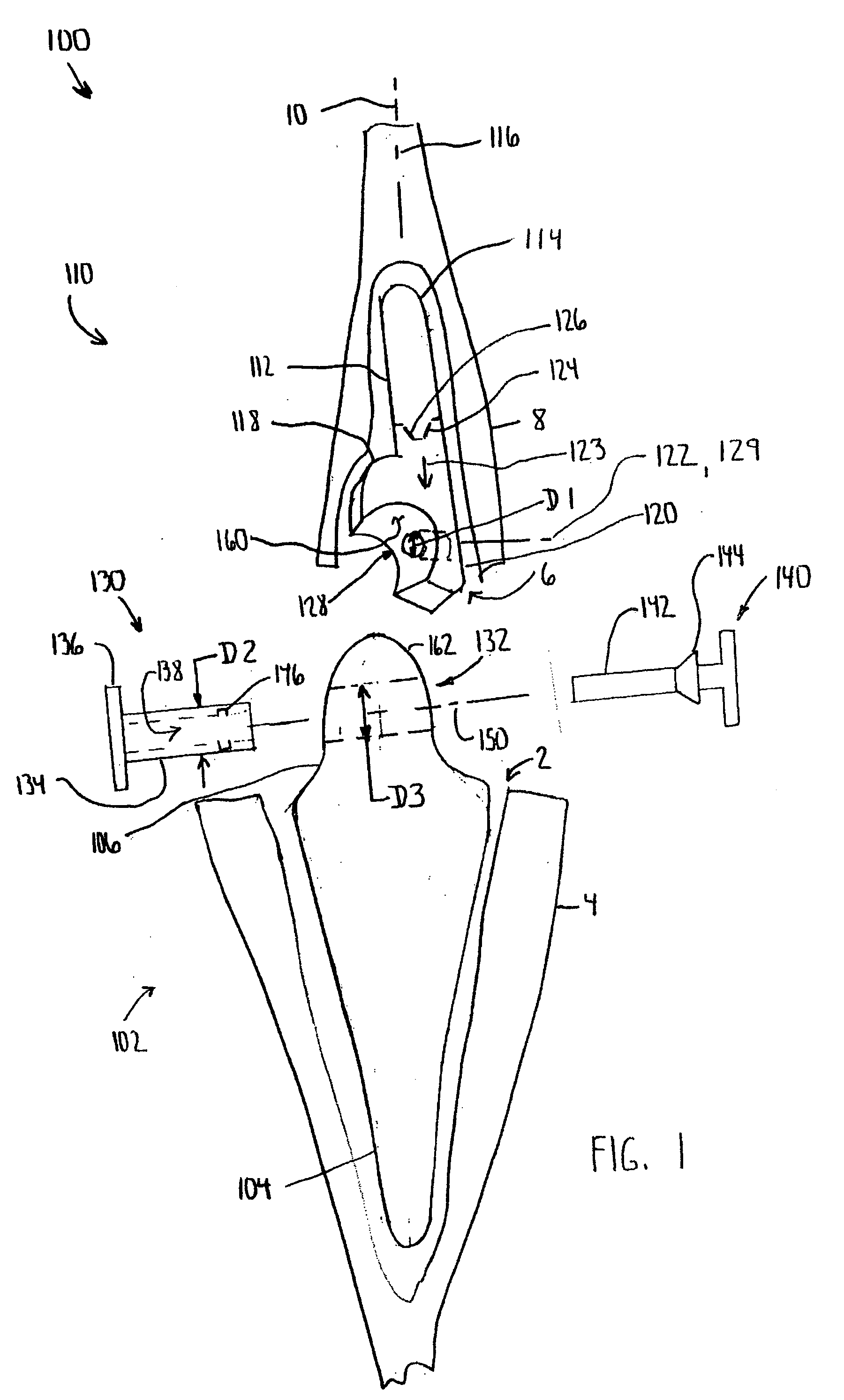 Modular total elbow humeral component and associated methods