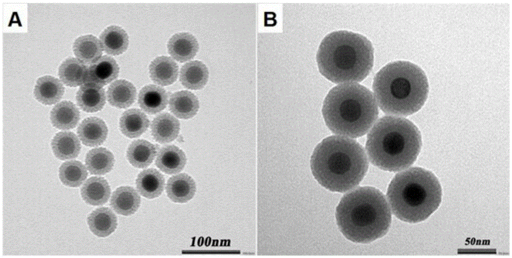 Sound-control nanoparticle-loaded berberine releasing system and preparation method and application thereof