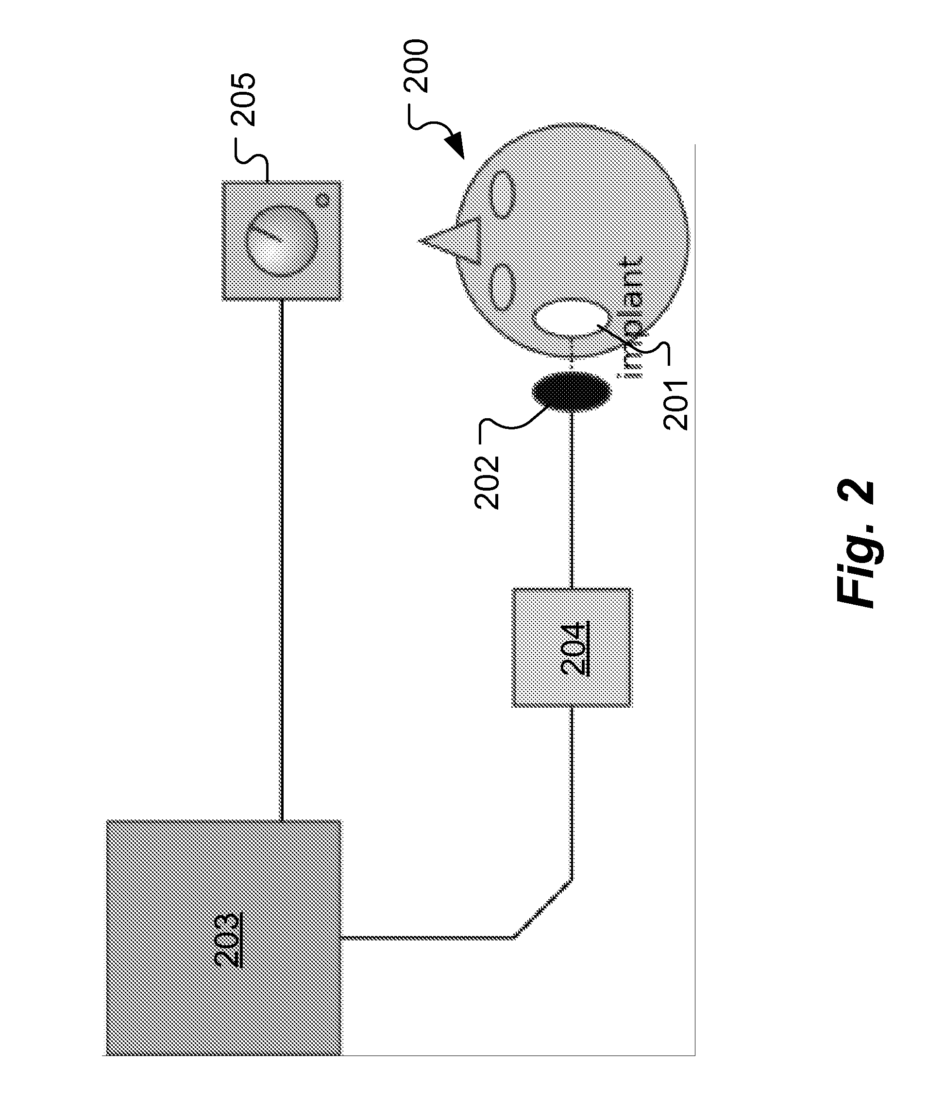 Method For Fitting A Cochlear Implant With Patient Feedback