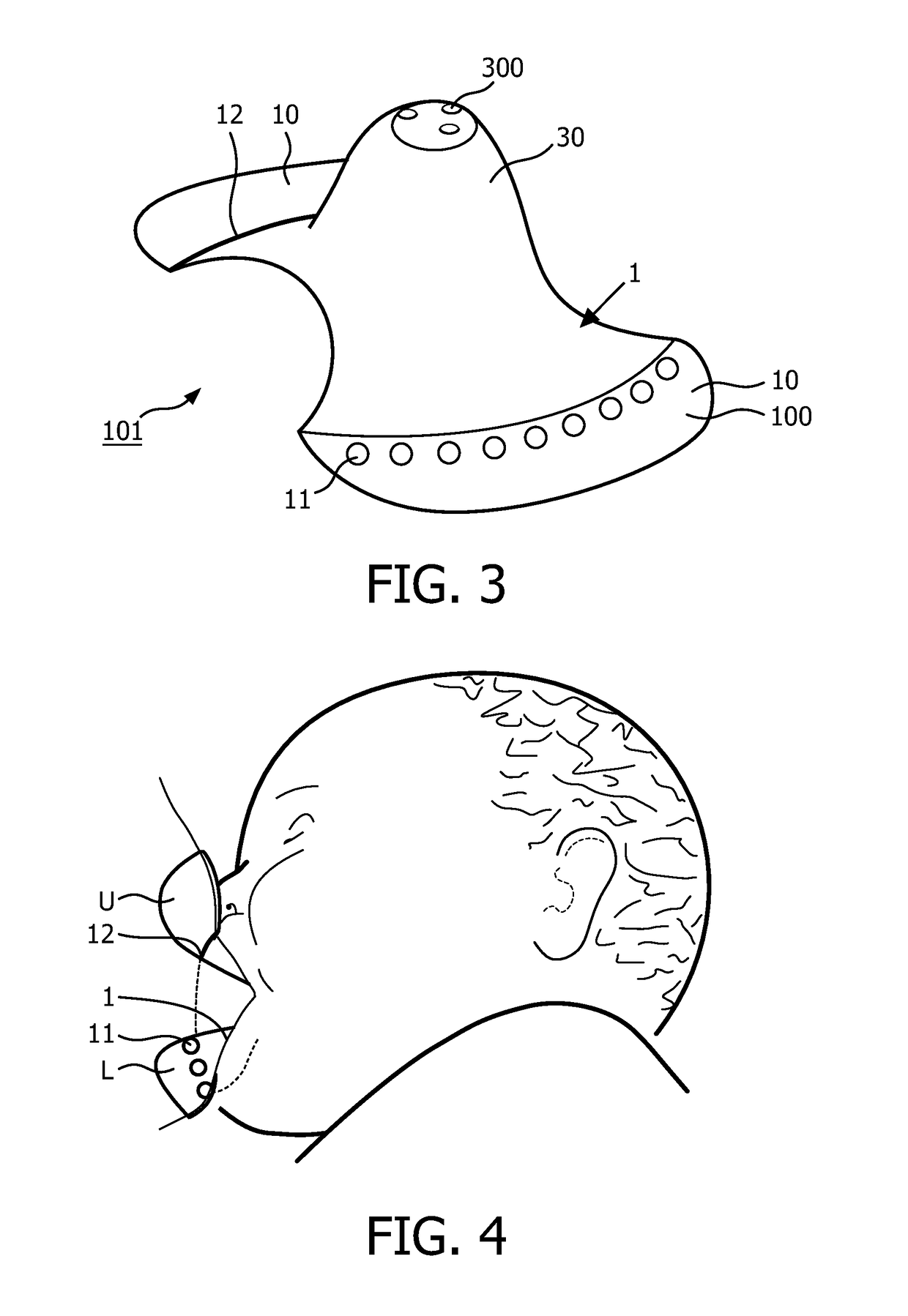 Device and method for guiding latch-on