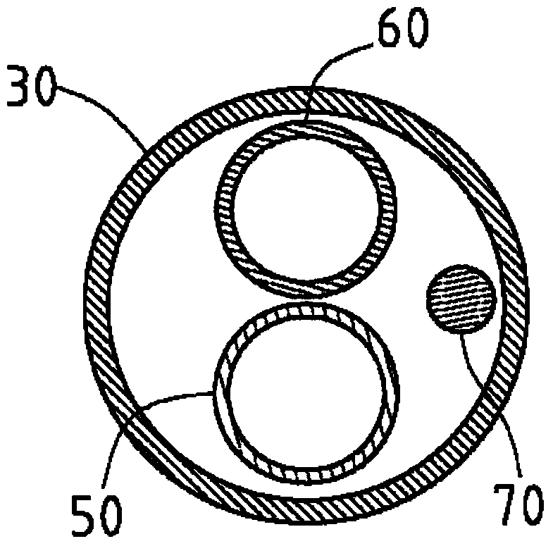 catheter