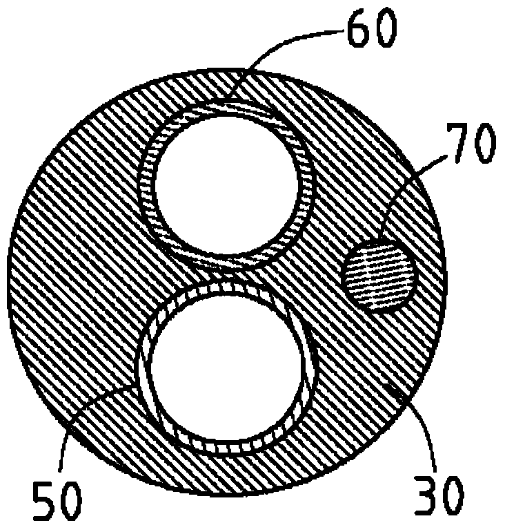 catheter