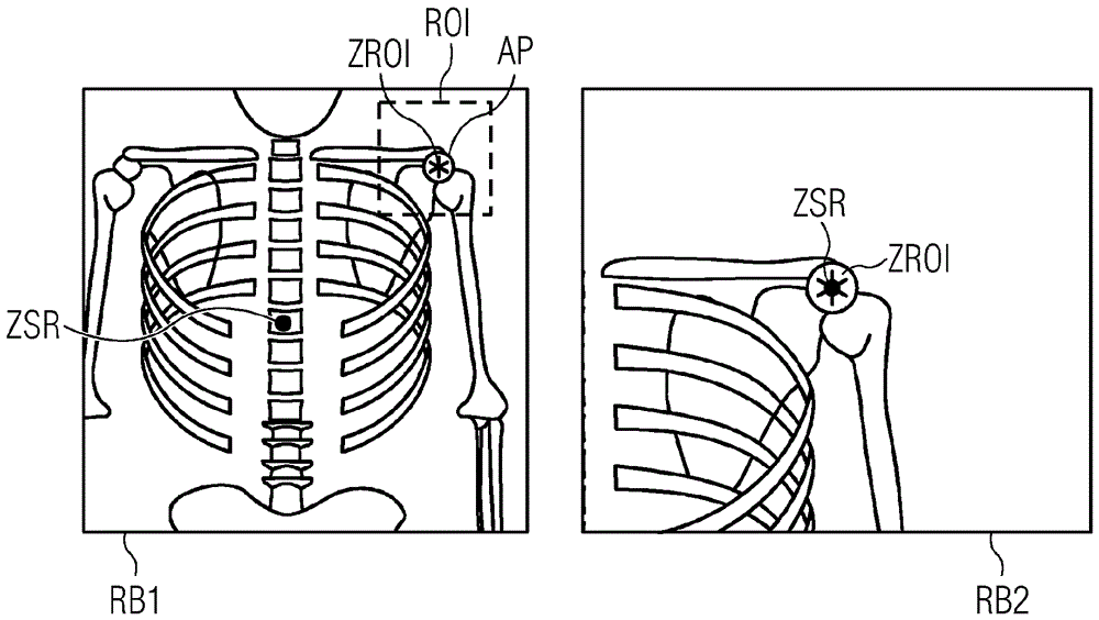 Mobile X-ray apparatus