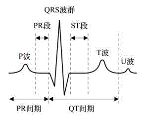 Pulse regression model-based electrocardiography data correction method and system