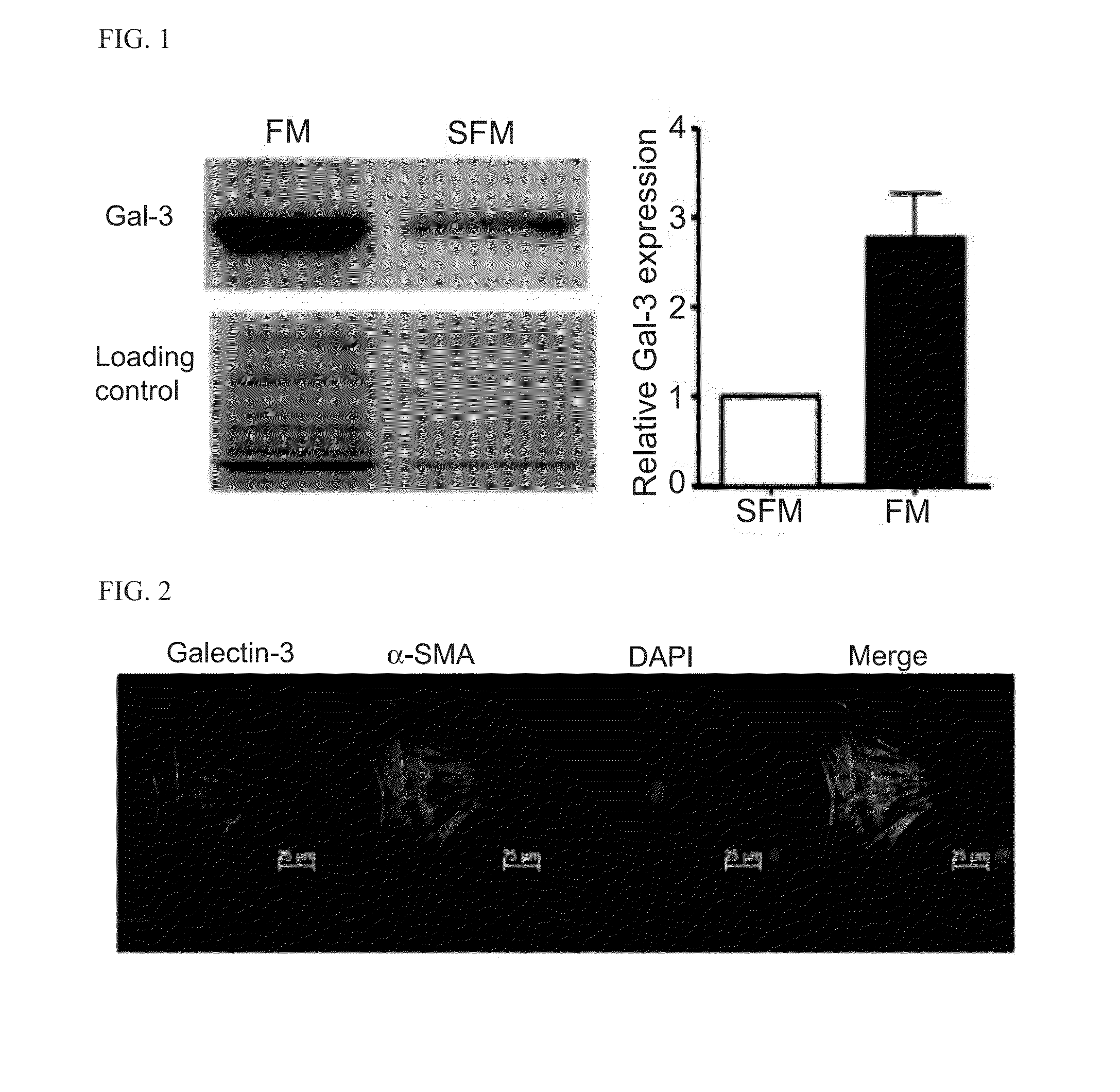 Methods and compositions for treating atrial  fibrillation