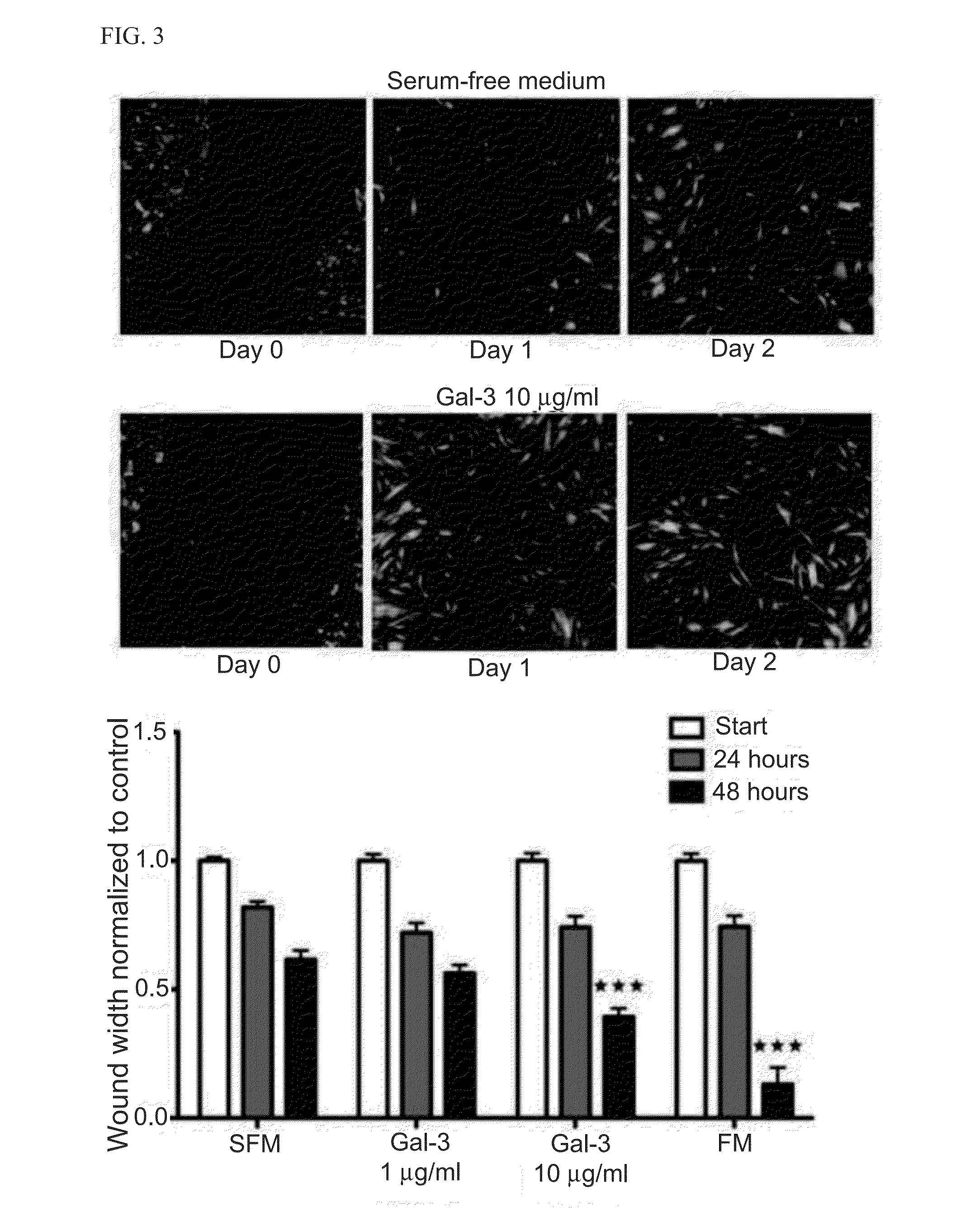 Methods and compositions for treating atrial  fibrillation