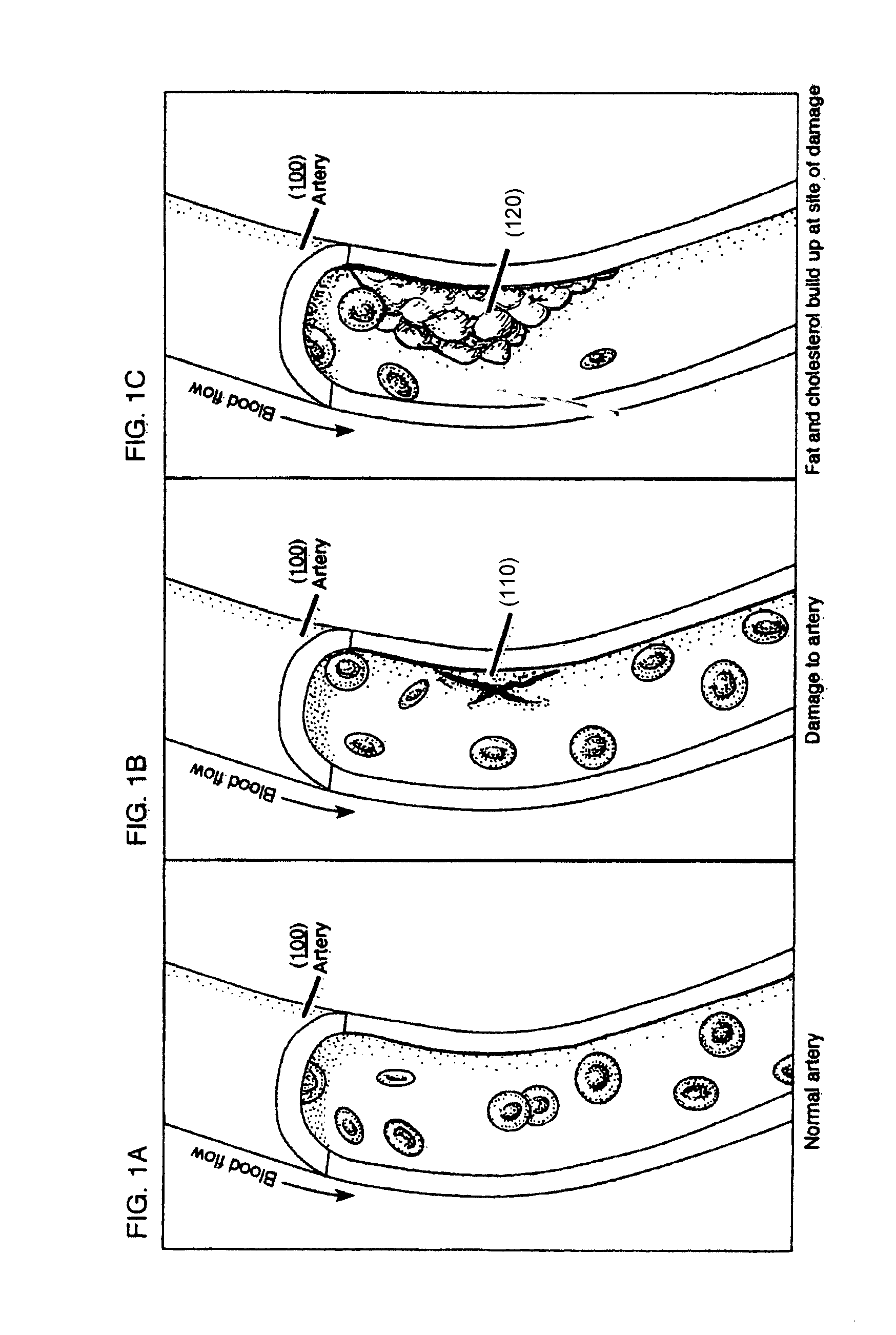 Methods and compositions to treat myocardial conditions