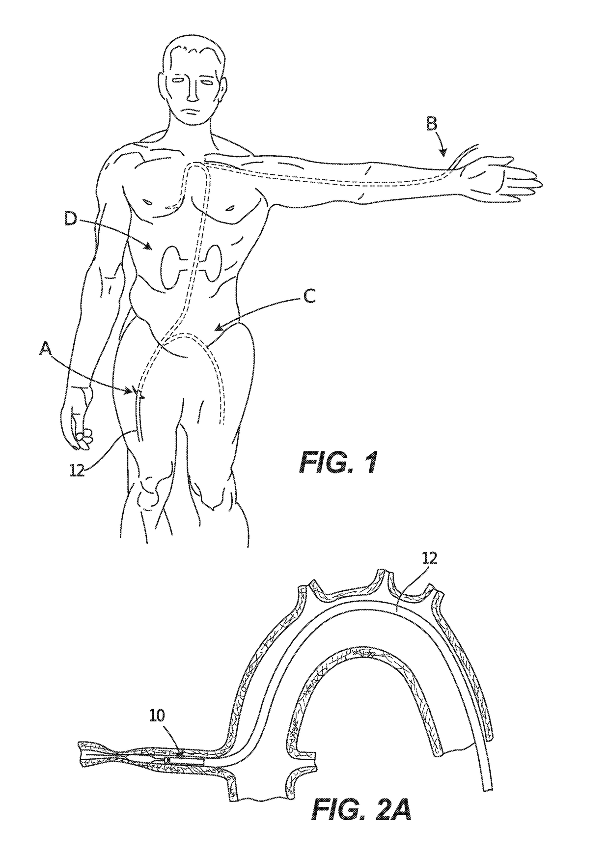 Catheter Structure with Improved Support and Related Systems, Methods, and Devices