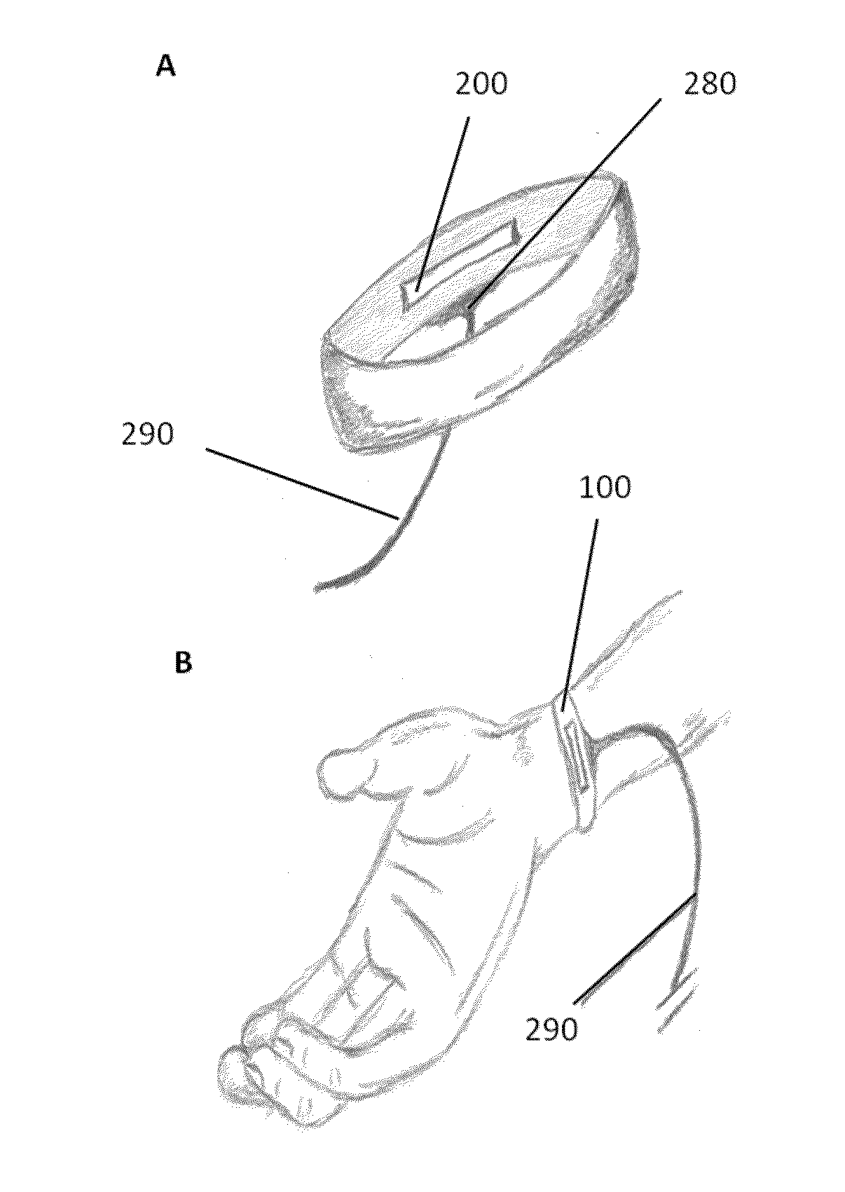 Biotelemetry system