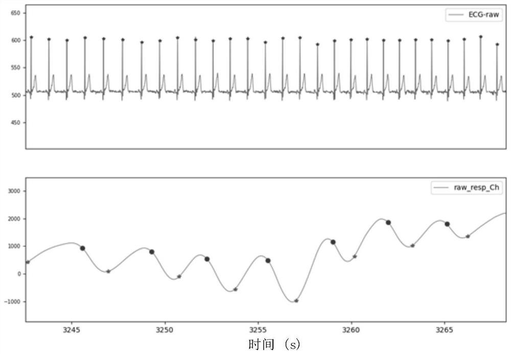 Continuous physiological signal quality assessment method