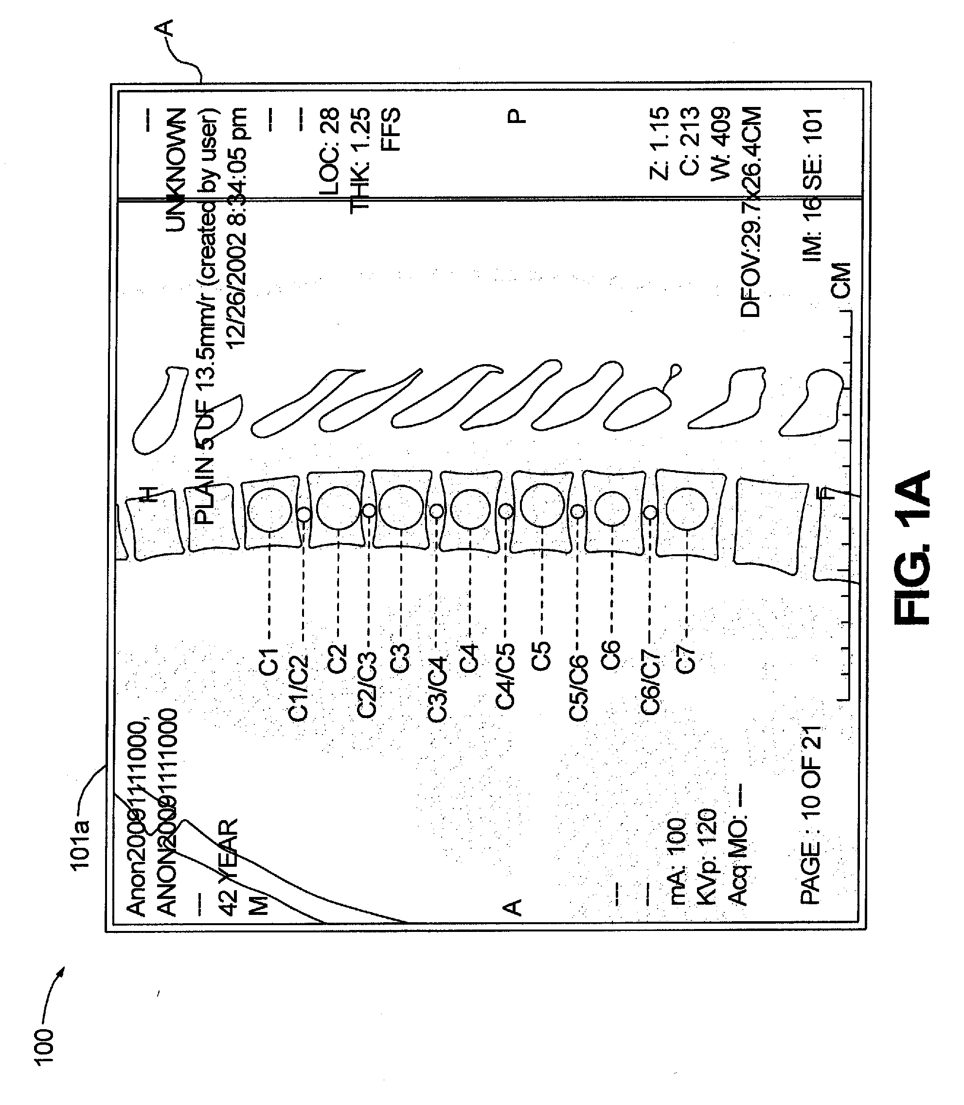 System and Method for Propagation of Spine Labeling