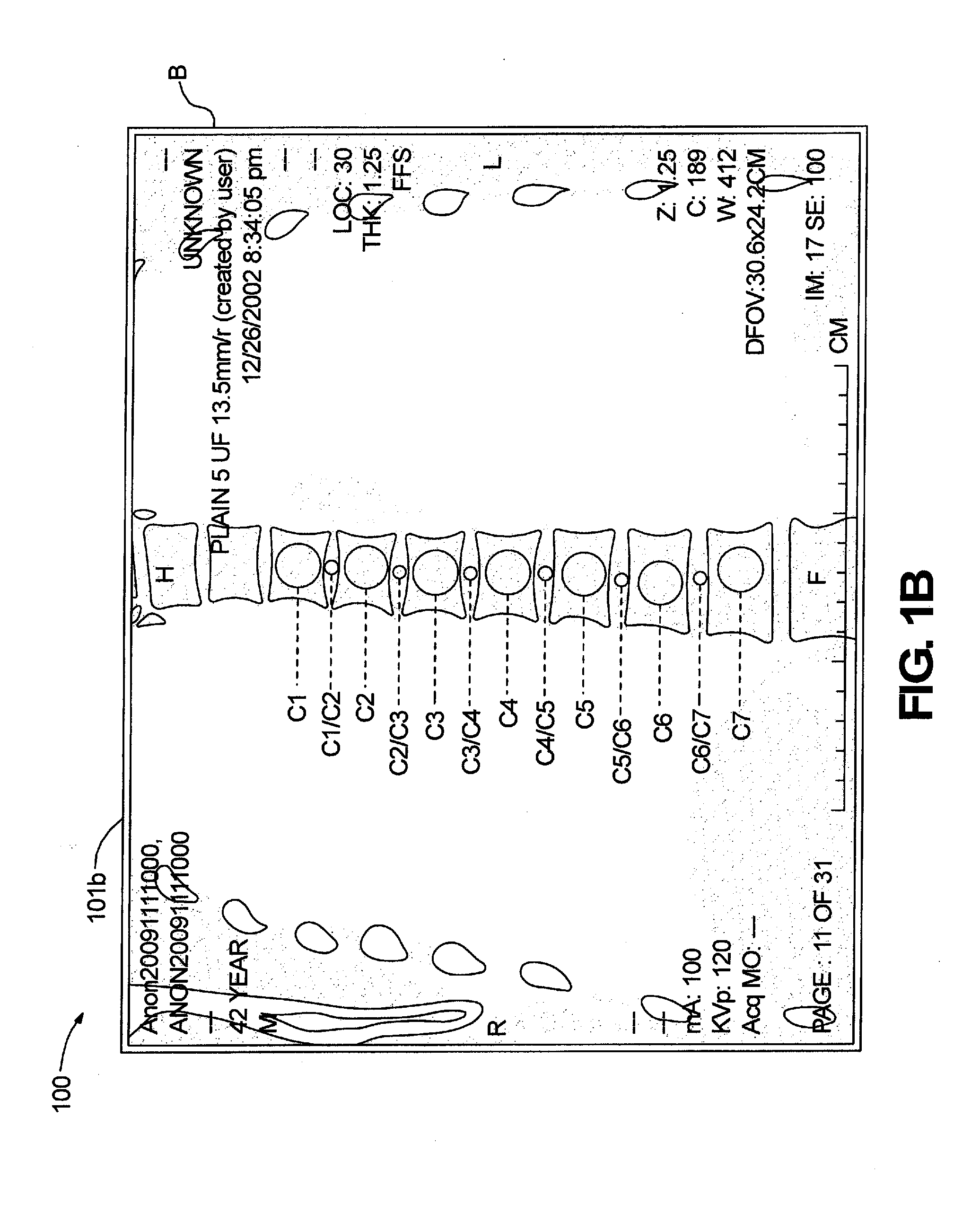 System and Method for Propagation of Spine Labeling