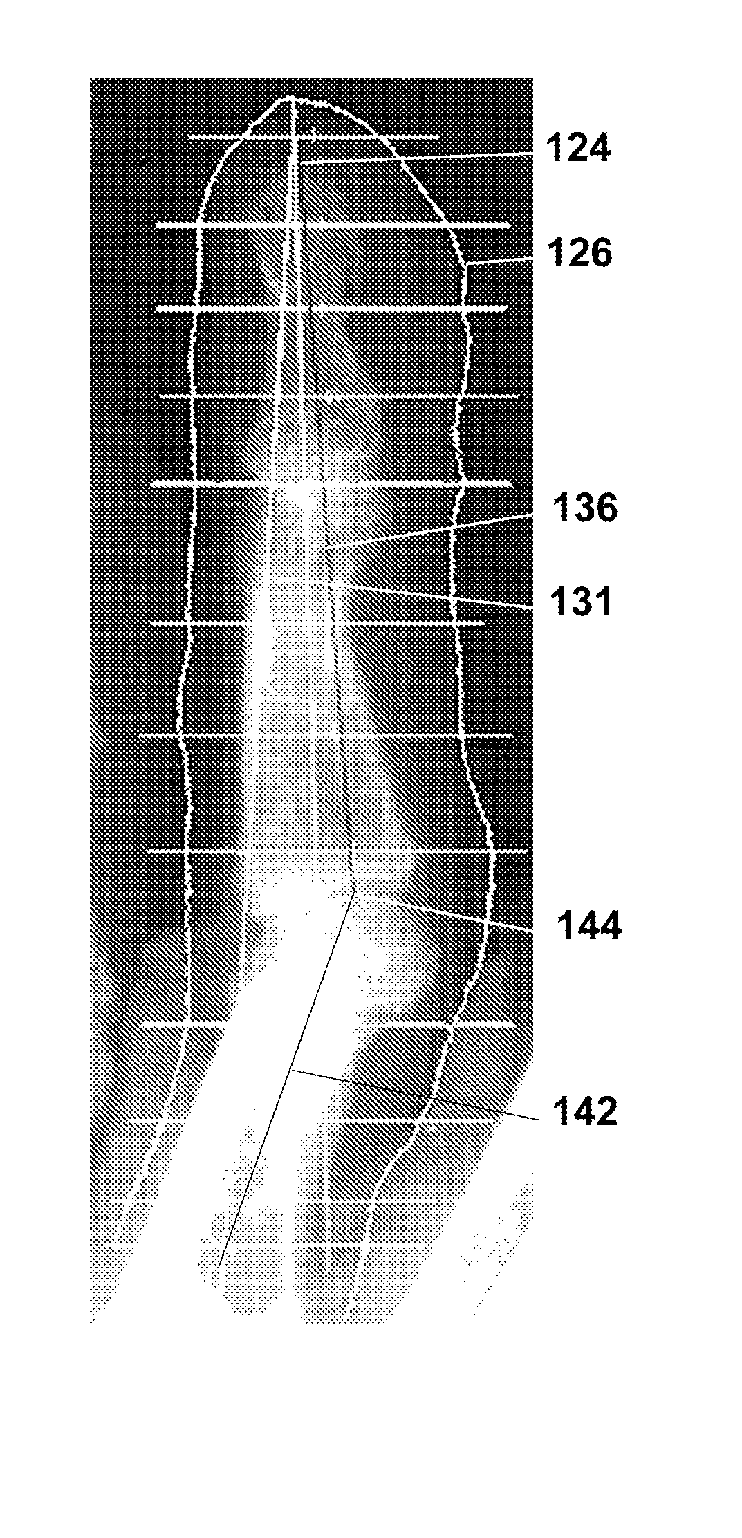 Method, code, and system for assaying joint deformity