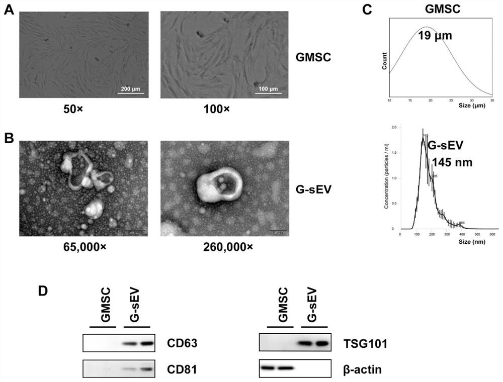 Application of mesenchymal stem cell-derived small extracellular vesicles to preparation of drugs for treating autoimmune diseases