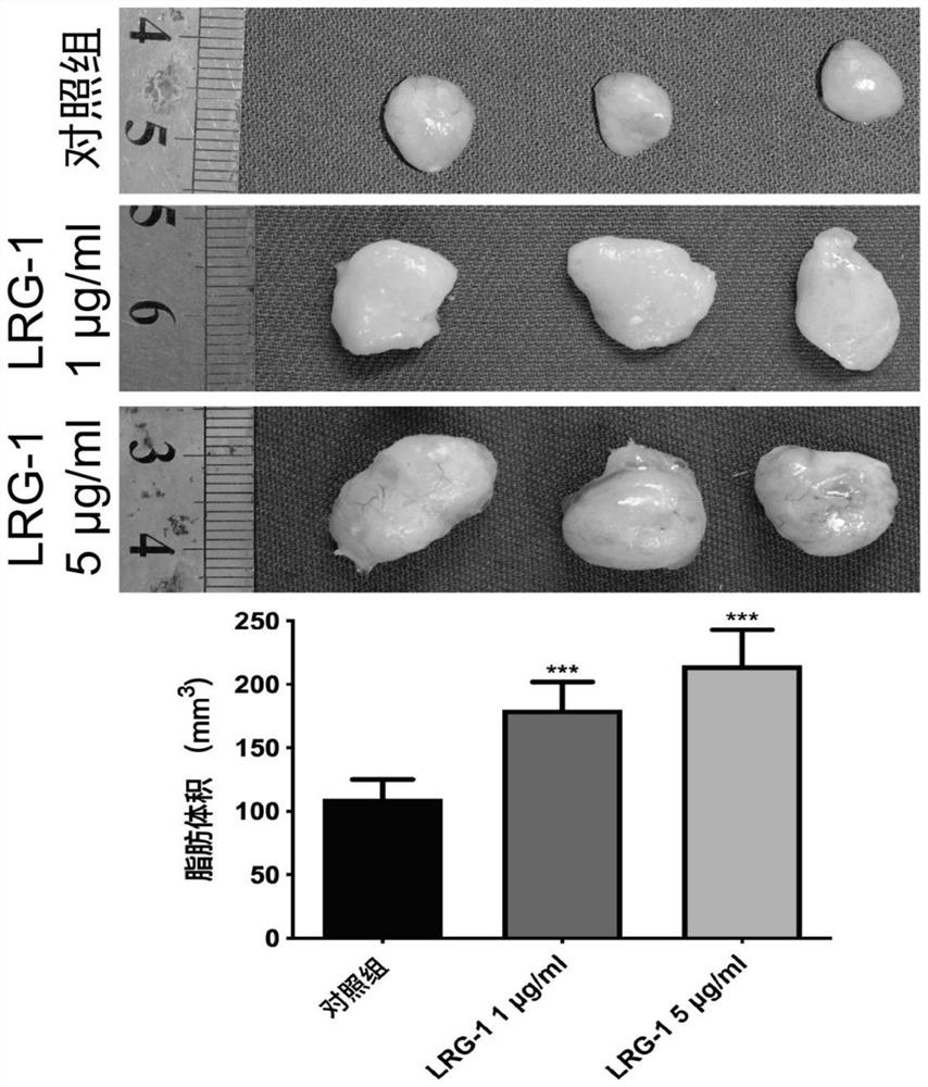 Application of LRG1 gene or protein coded by LRG1 gene in preparation of medicine for reducing autotransplantation fat cell apoptosis