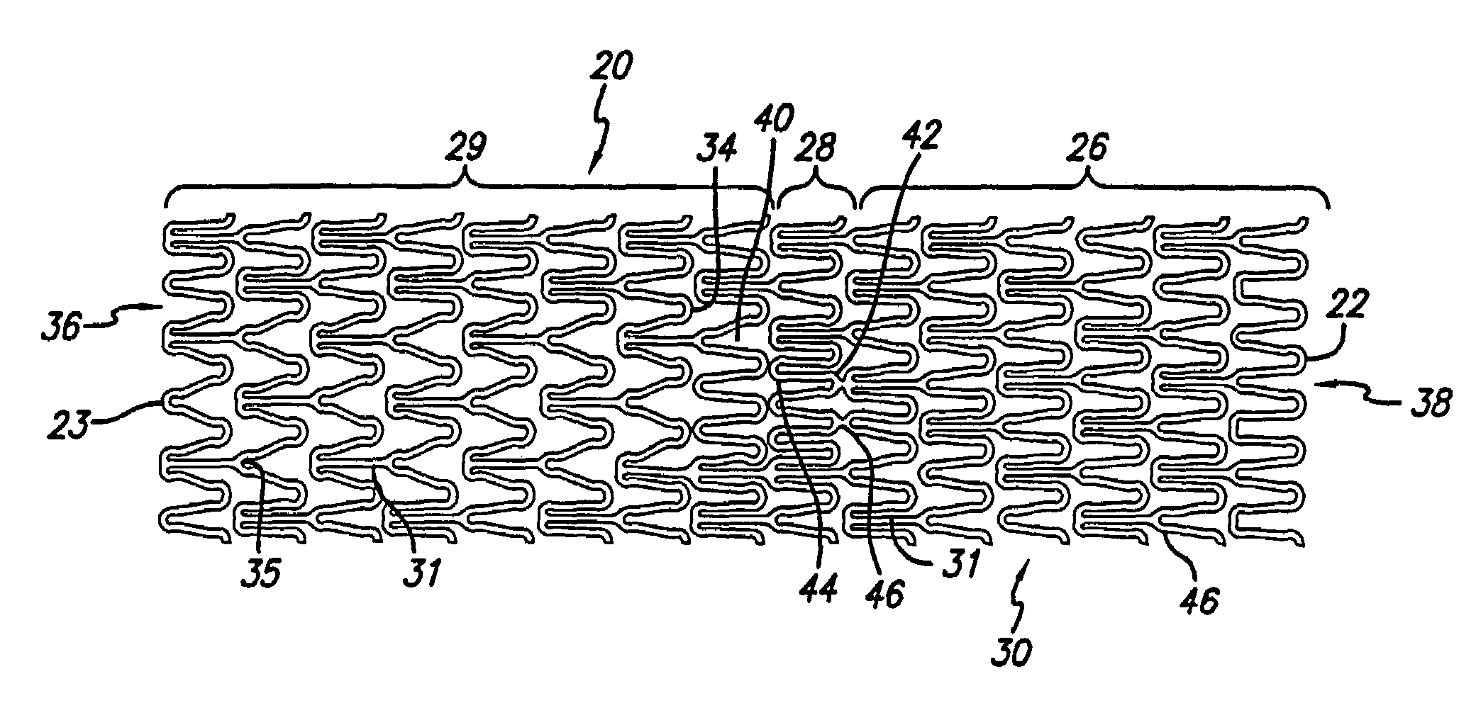 Portal design for stent for treating bifurcated vessels