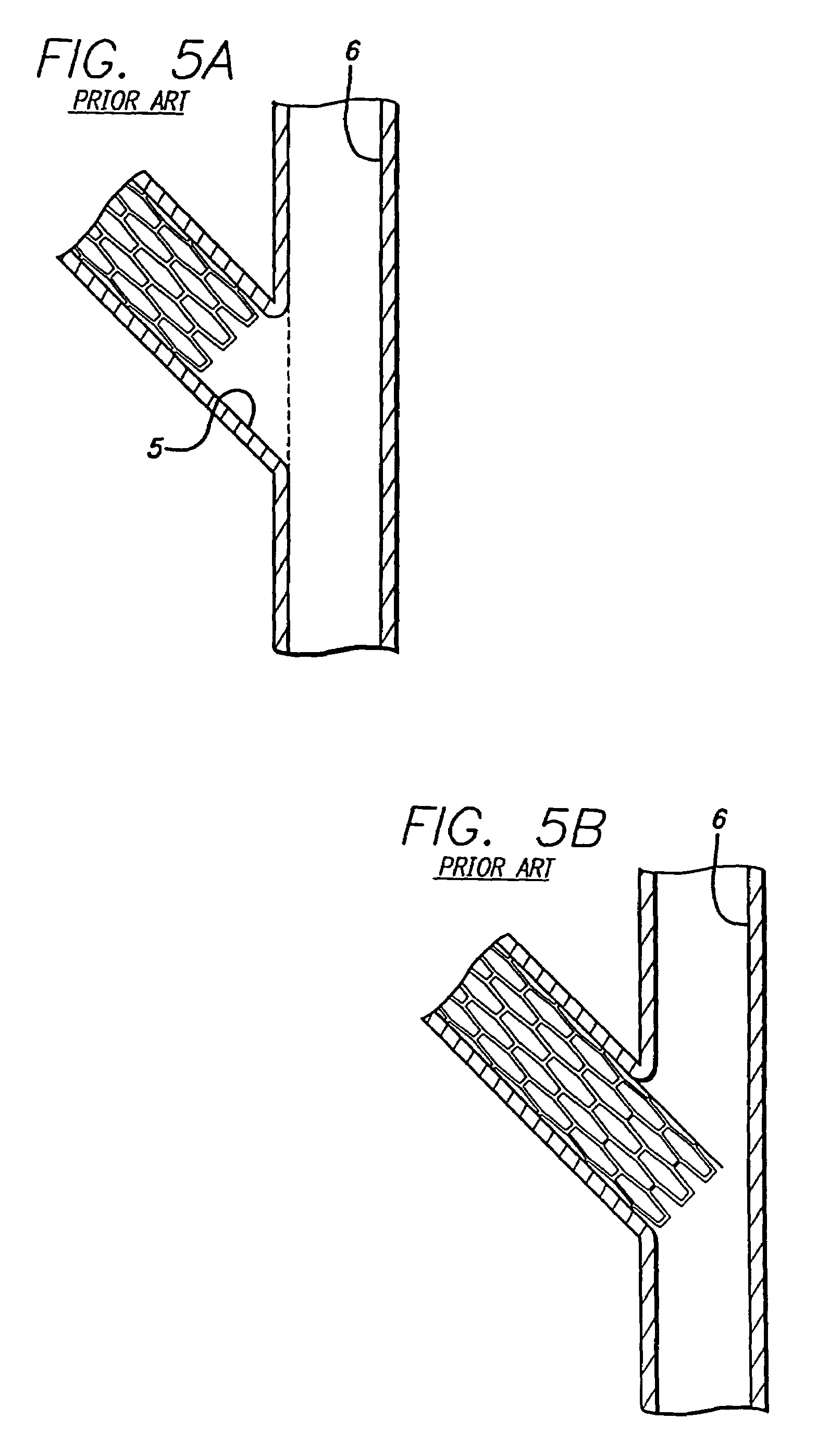 Portal design for stent for treating bifurcated vessels