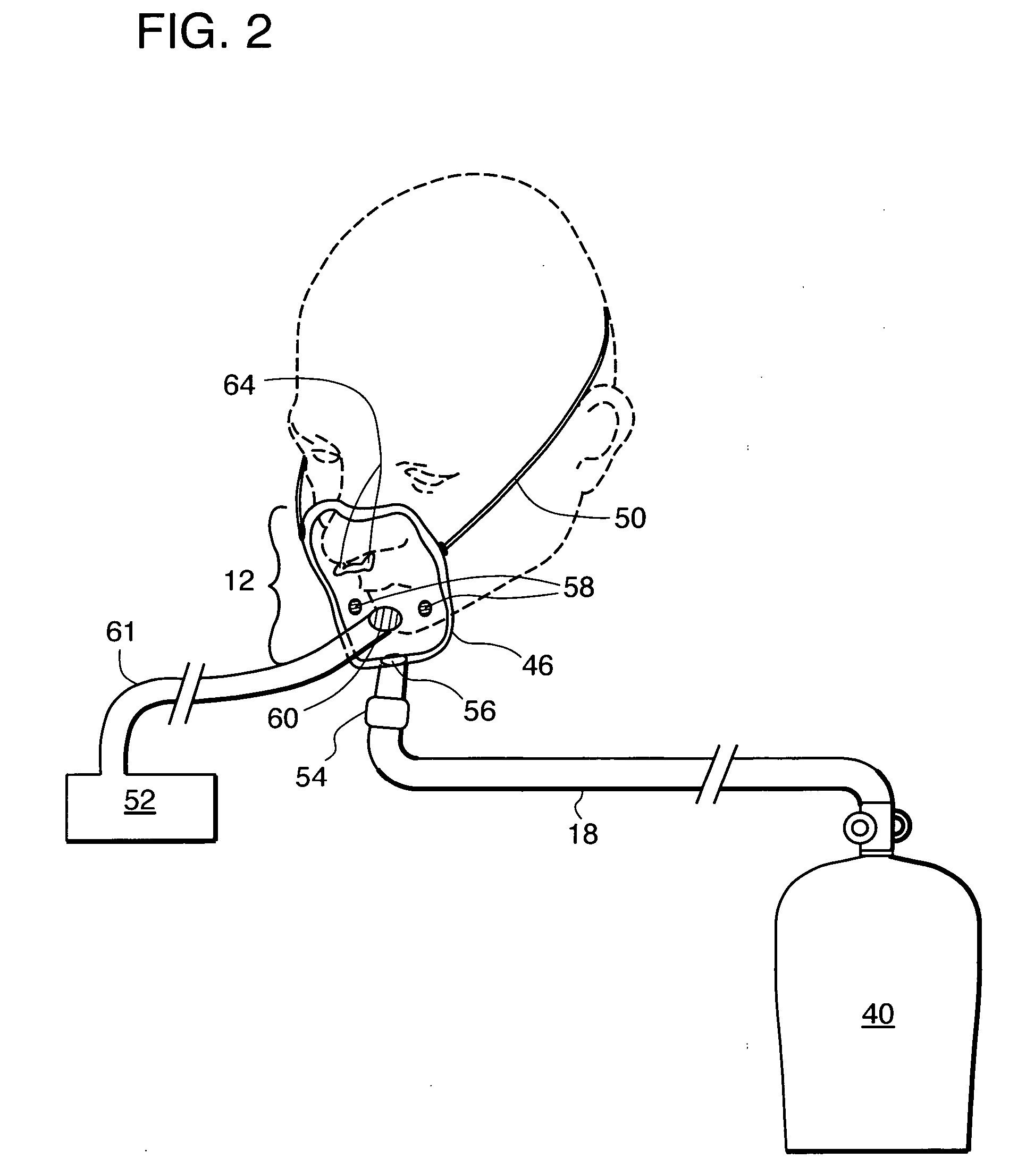 High-flow oxygen delivery system and methods of use thereof