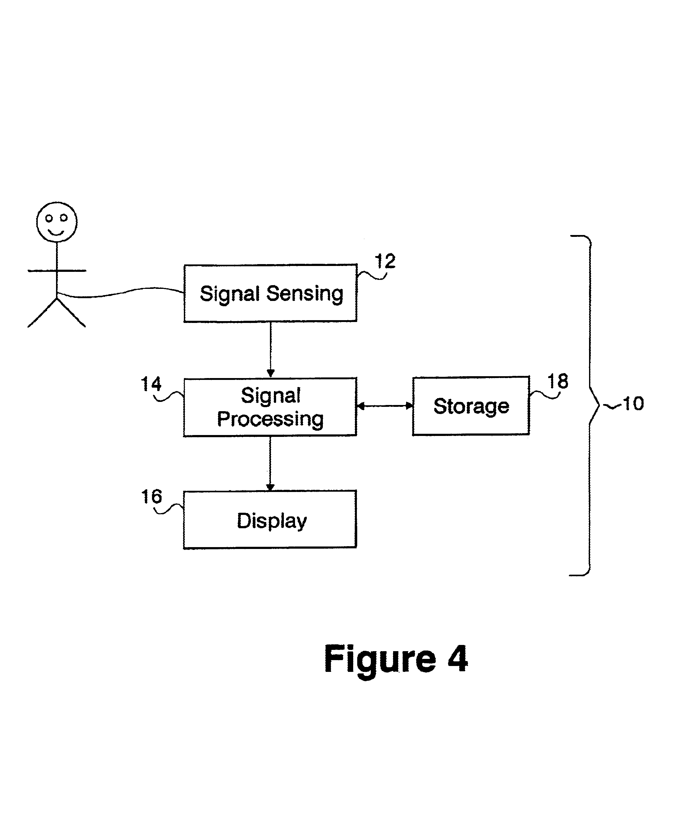 Methods for processing electrocardiac signals having superimposed complexes